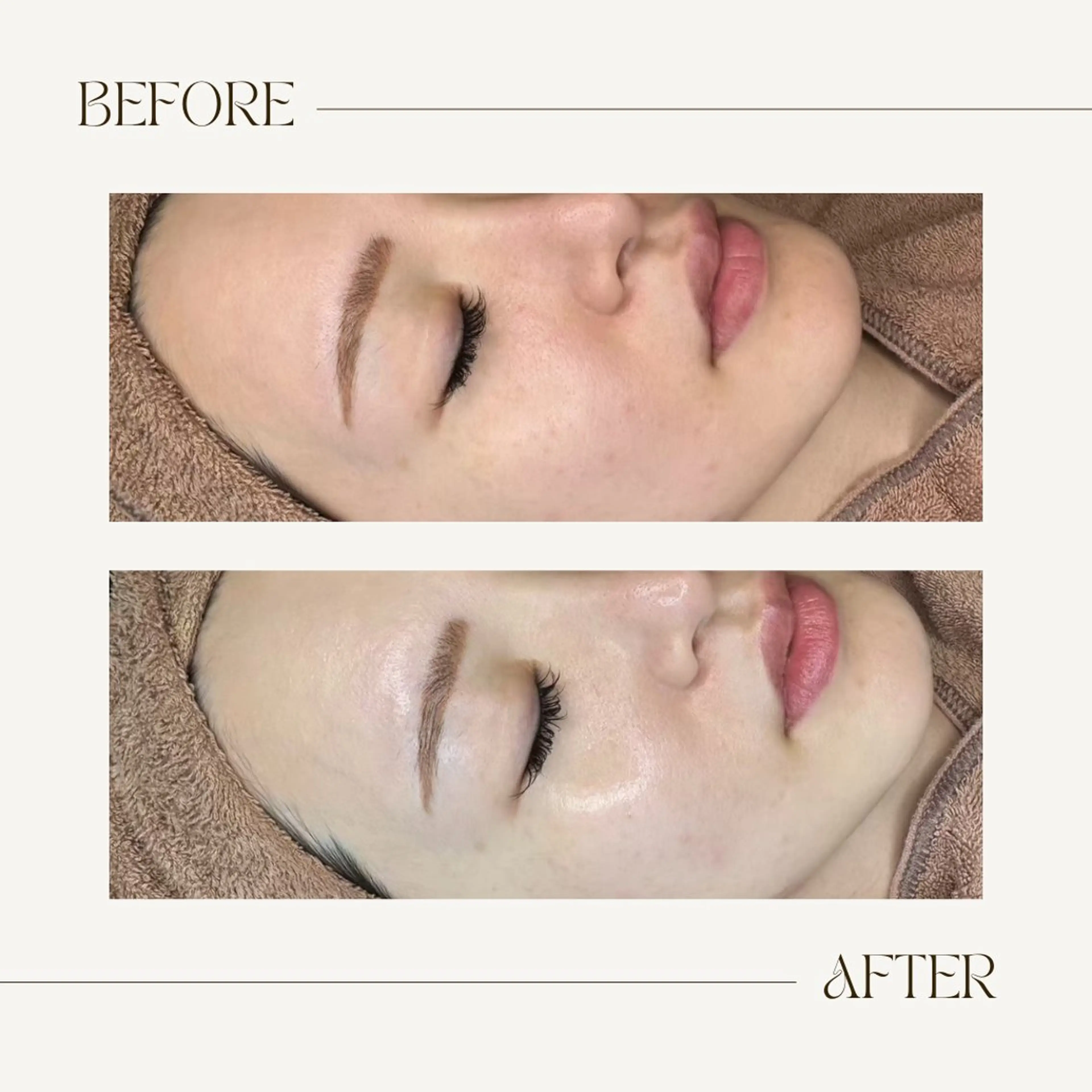 【韓国式肌管理】敏感肌OK◎ララピールでうる艶たまご肌✨の写真