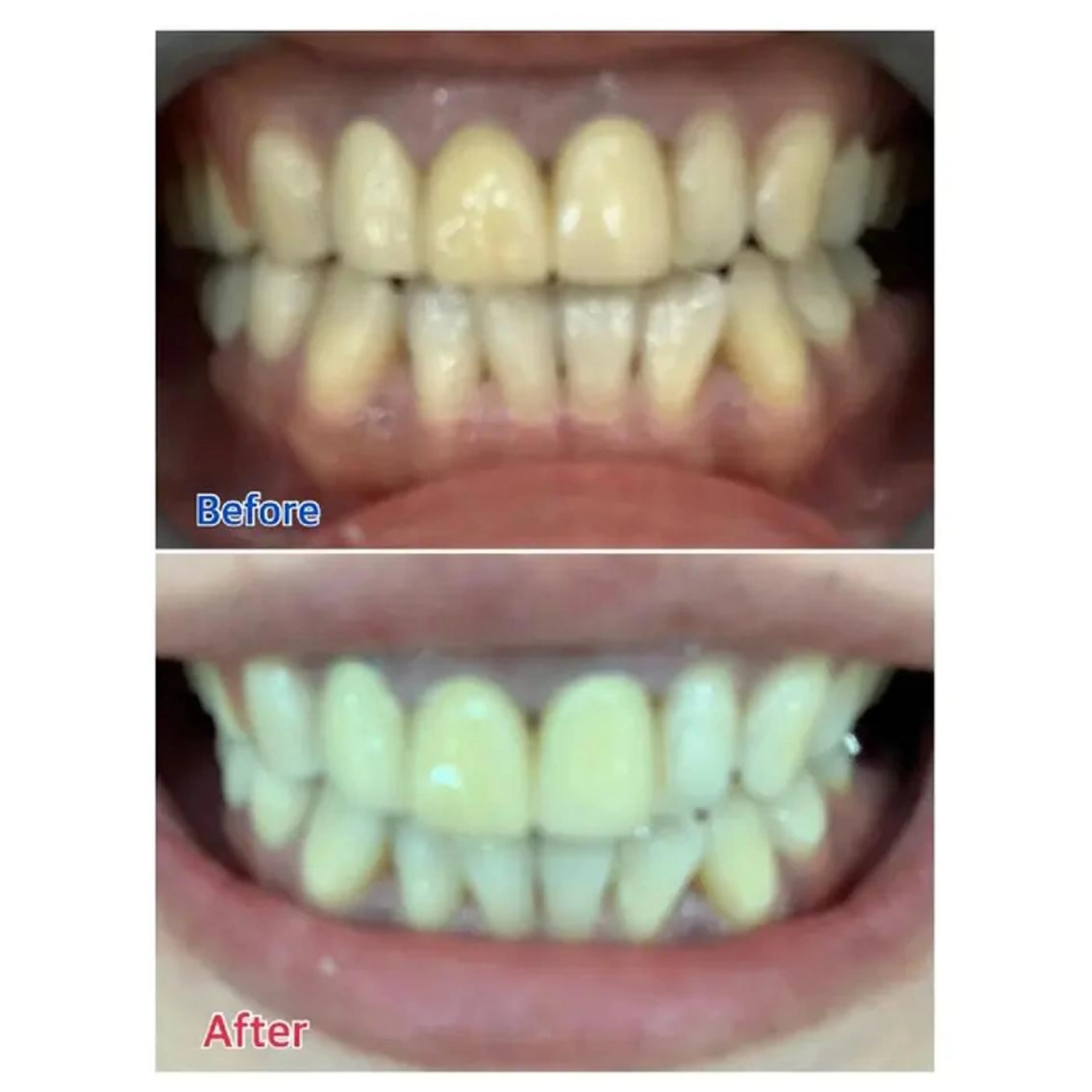 M渋谷店所属・M渋谷 ホワイトニングのエステ・リラクイメージ