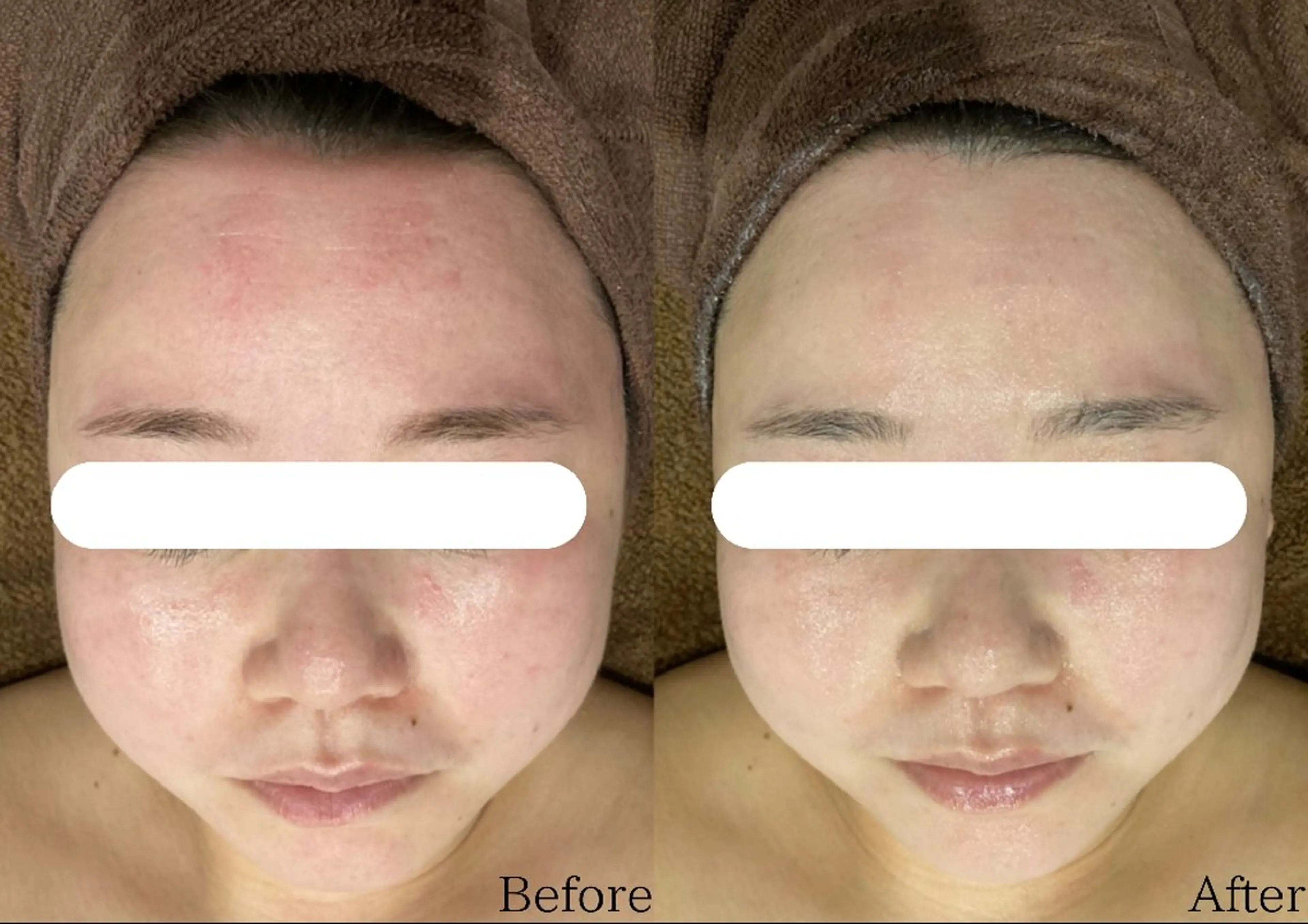 エステ DahliaBeauty ダリアビューティー所属・Dahlia 痩身 フェイシャル 中村のエステ・リラクイメージ