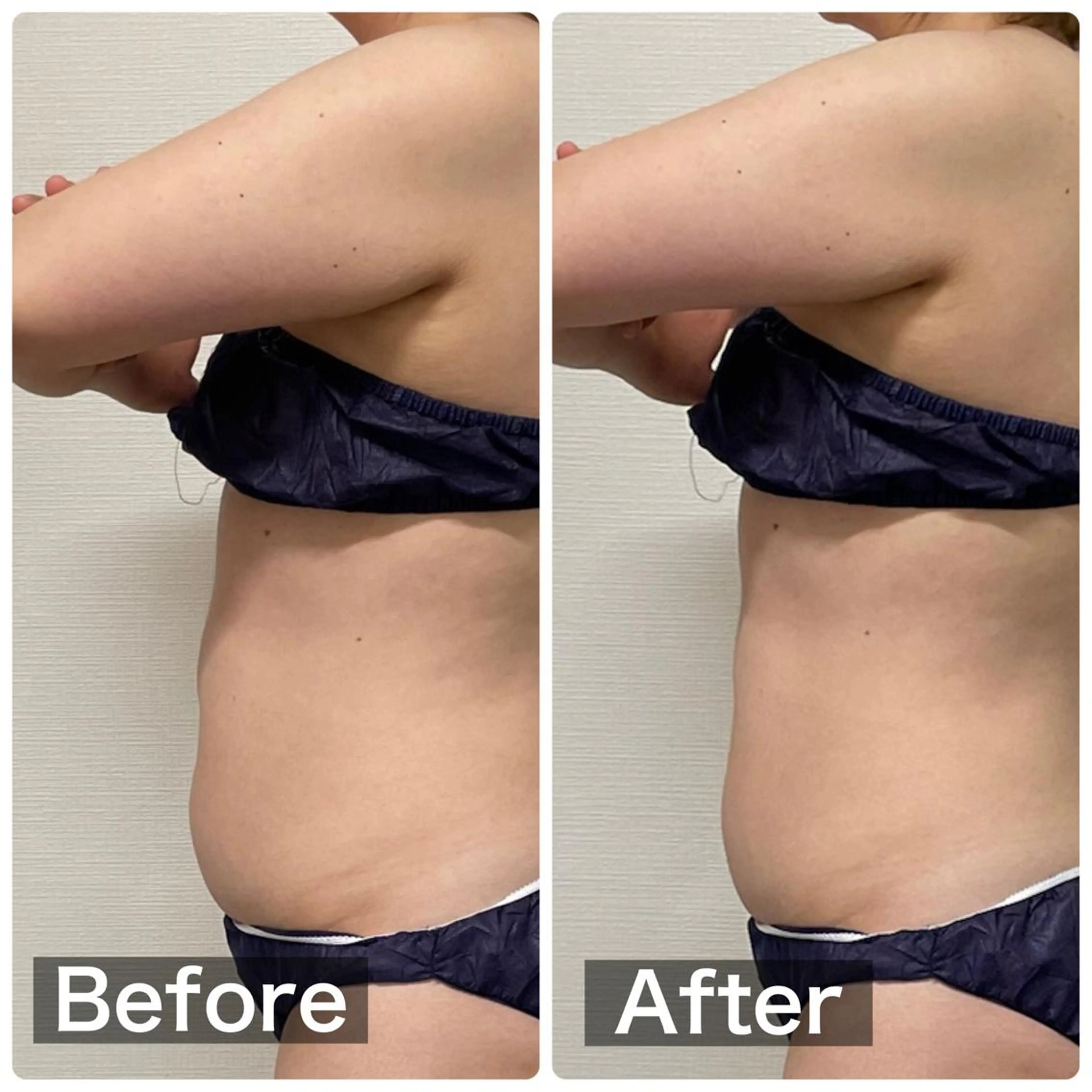 beauty salon  SUKOBI所属・ﾋﾞｭｰﾃｨｻﾛﾝ SUKOBIのエステ・リラクイメージ