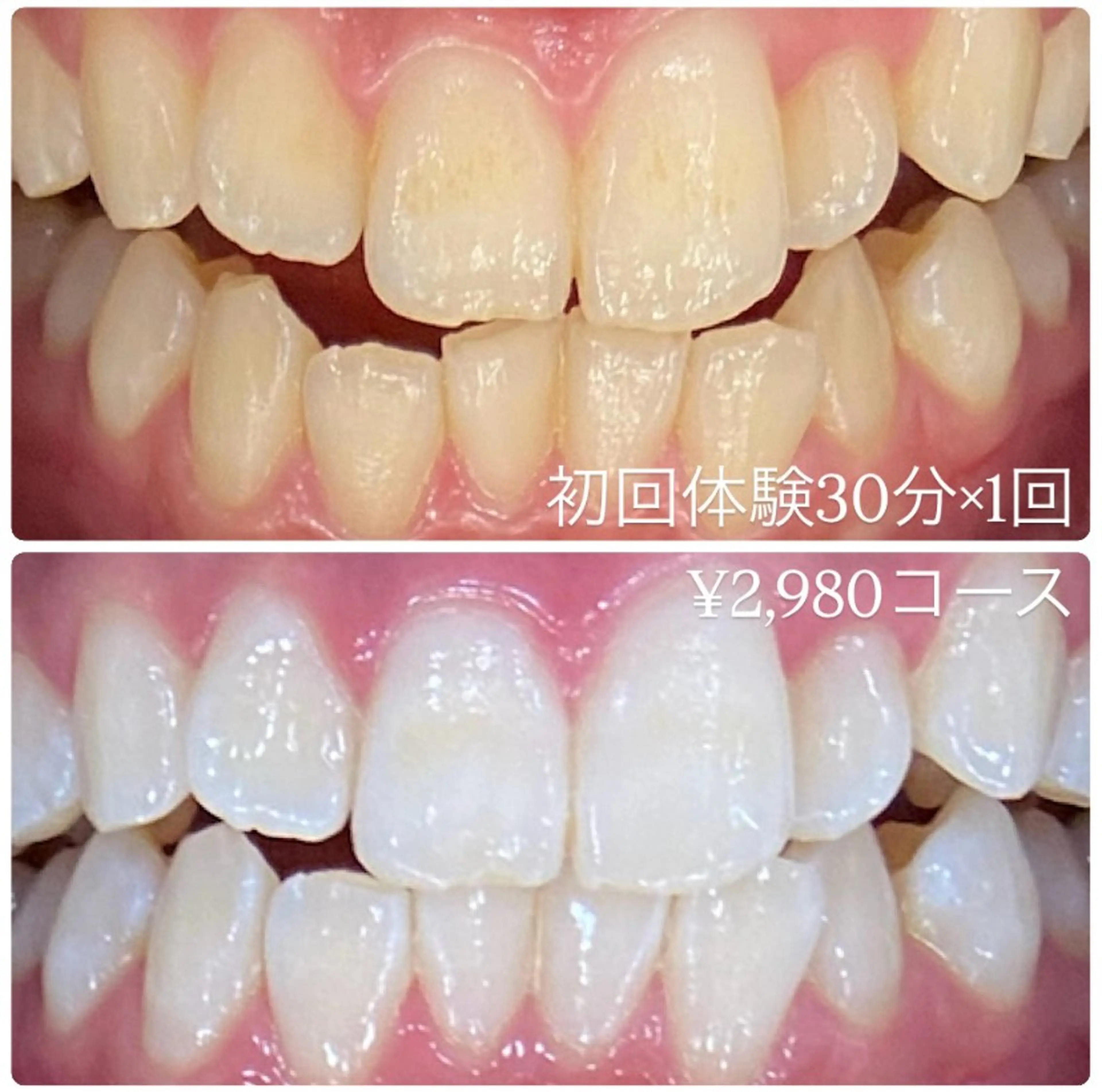 PLATINUM Beauty 横浜店所属・ホワイトニングルーム 横浜店のその他イメージ