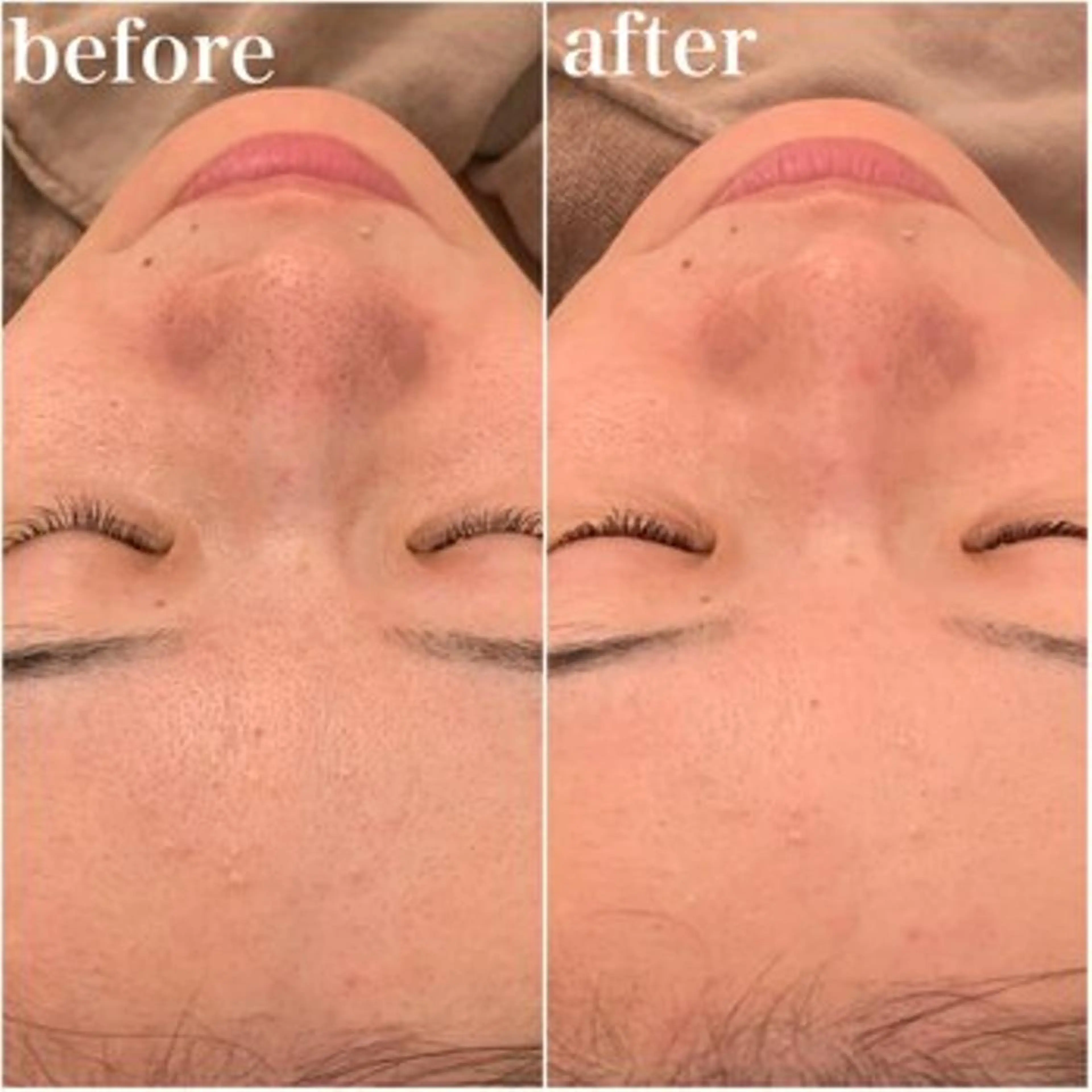 ✨美肌水光✨ アトリエリュバンのエステ・リラクイメージ