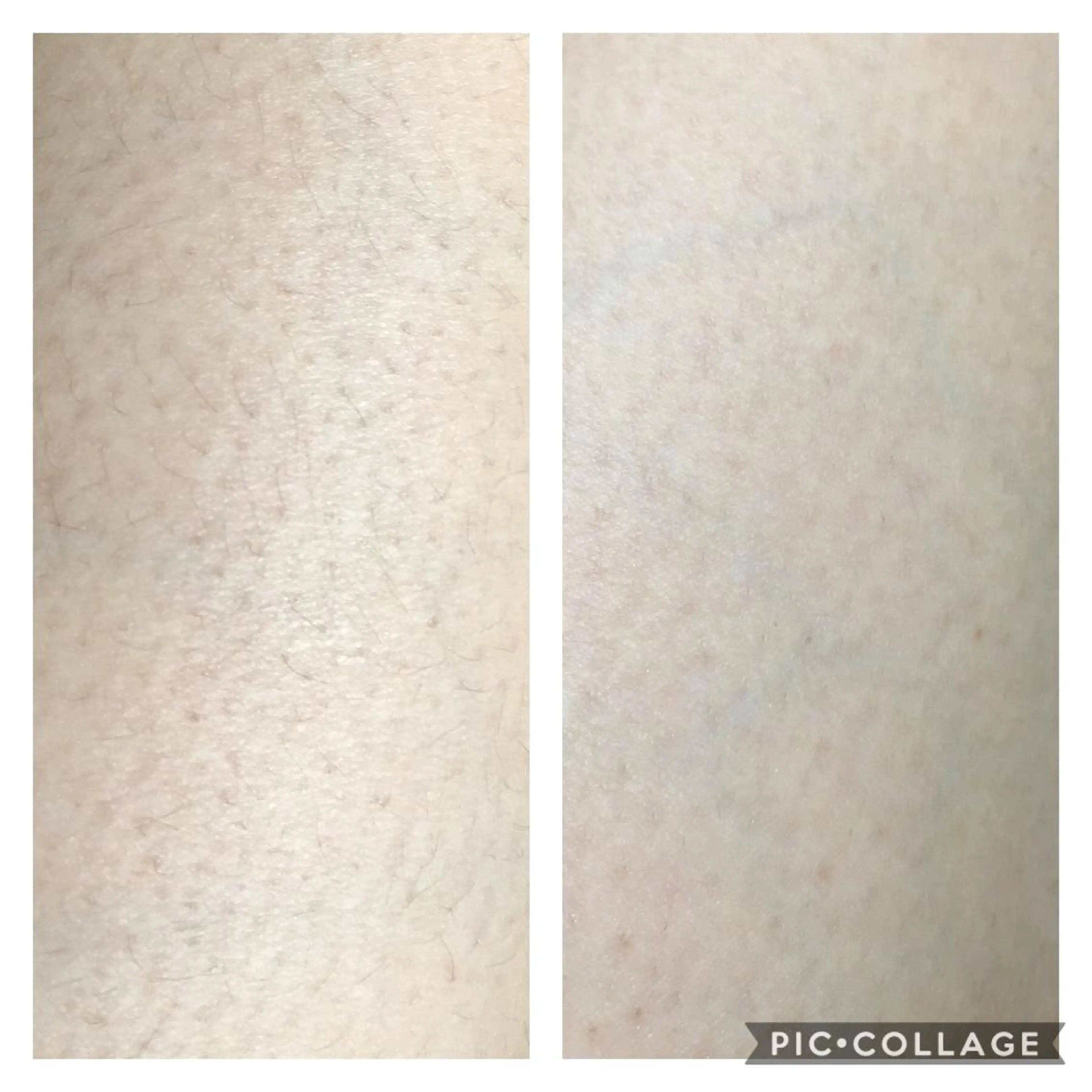 natura chuchuナトゥーラチュチュ所属・バスト体験 ナトゥーラチュチュのエステ・リラクイメージ