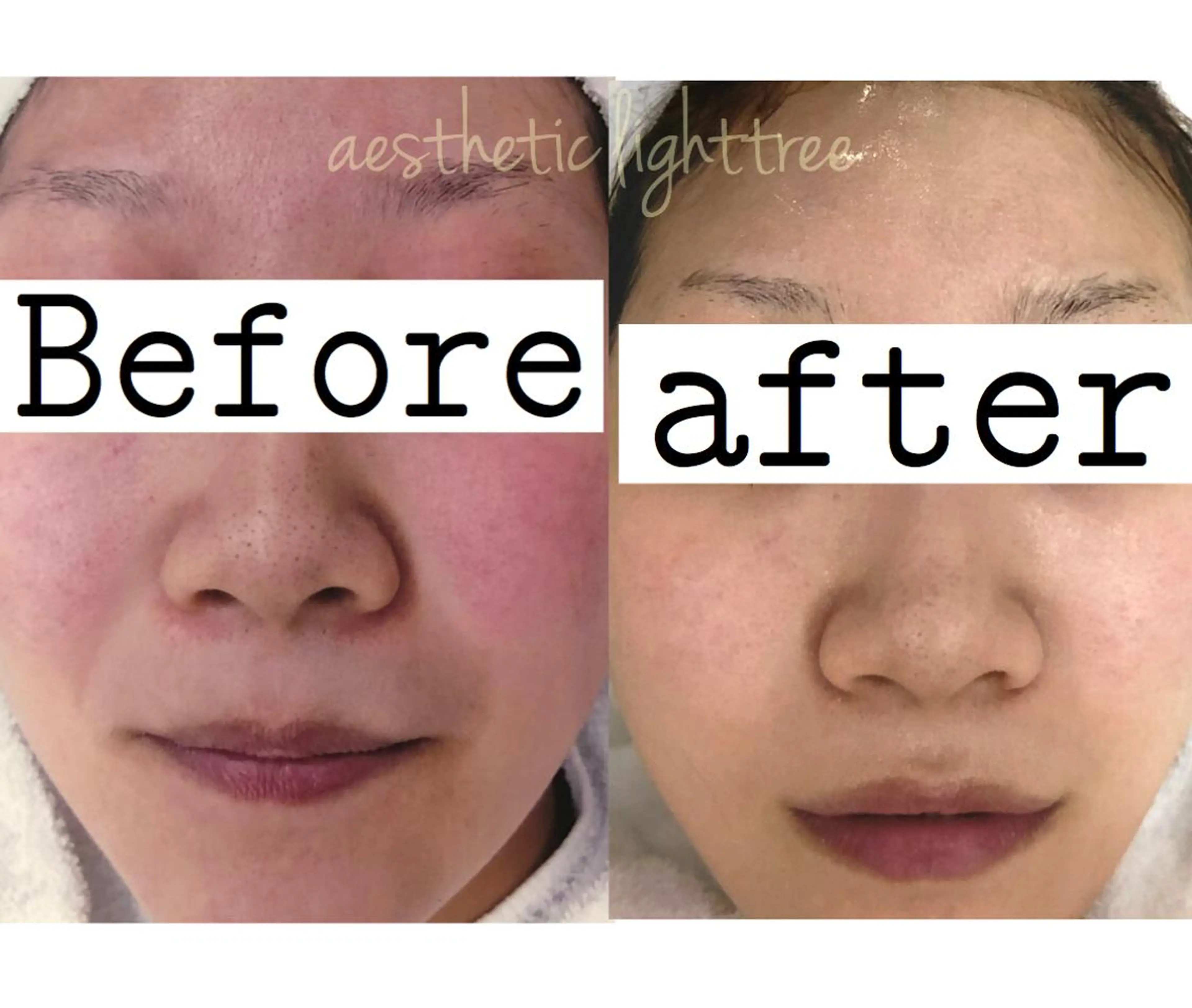 ショート カラー パーマ ヘアアレンジ メンズ キッズ ネイル マツエク・マツパ エステ ニキビ&跡改善サロン オーナー光木のエステ・リラクイメージ