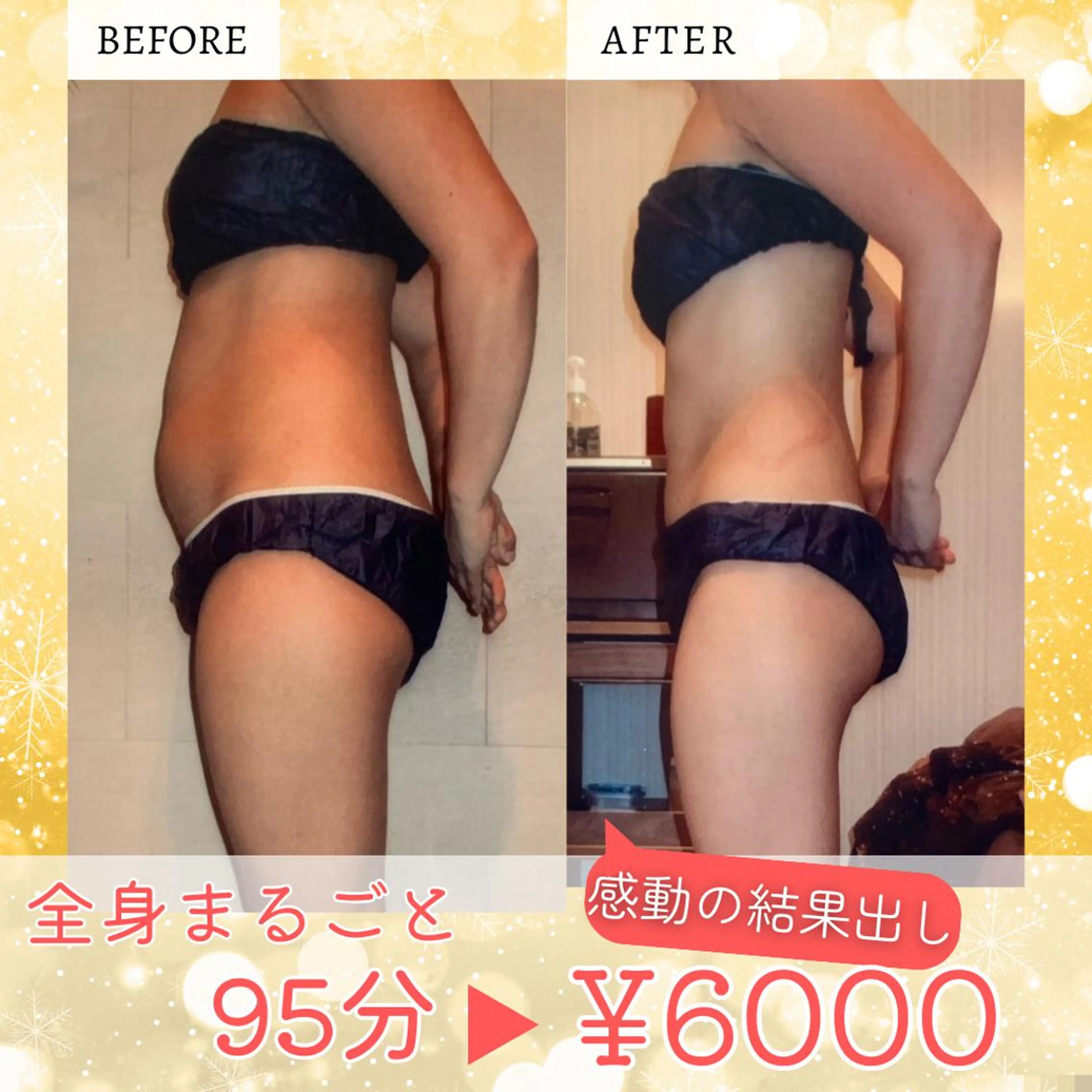 👑平日限定👑高コスパ☆!話題の一度で全身まるごと全身痩身95分¥37800⇒¥6000の写真