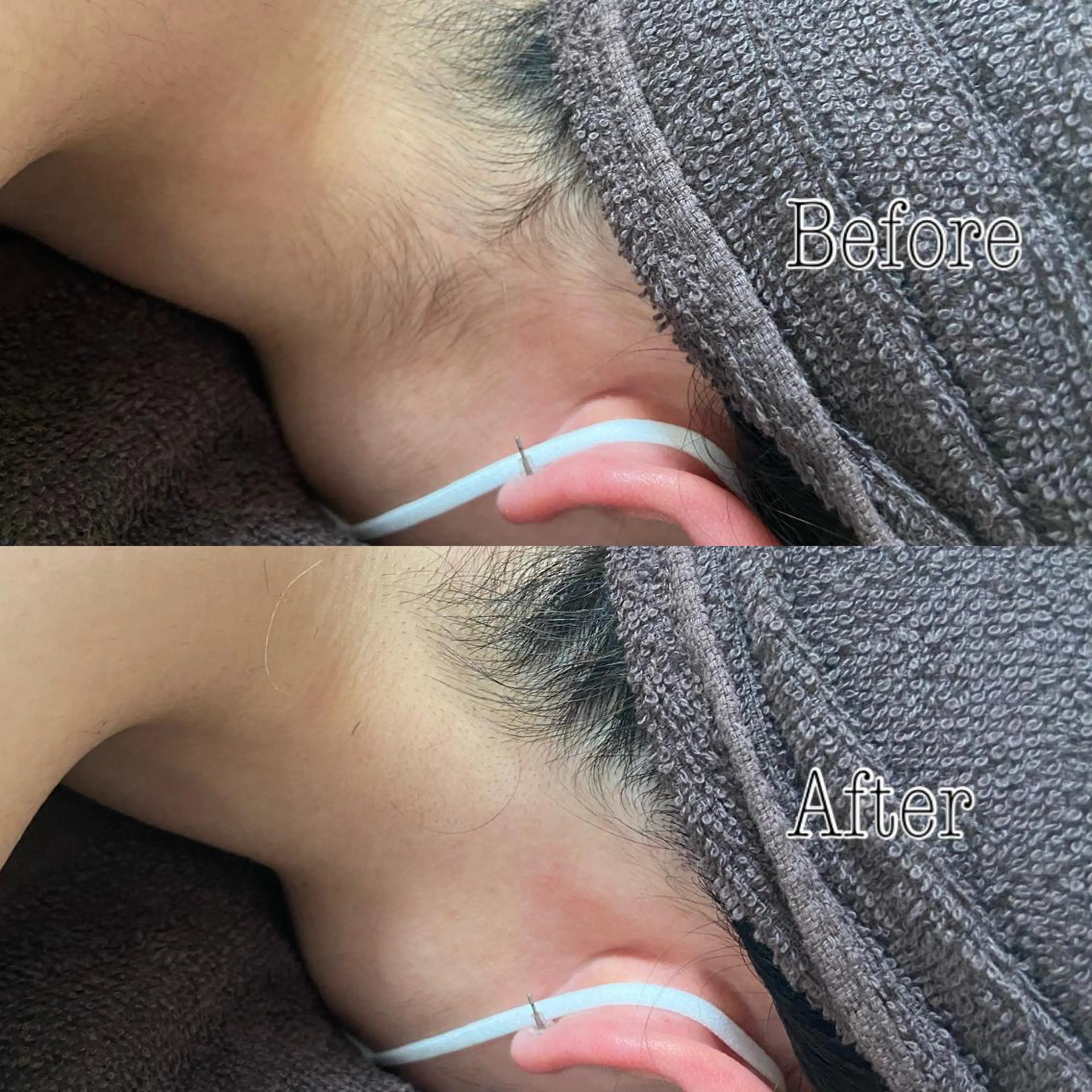 都度払い制脱毛サロンBe Charm所属・Be Charm 山﨑のエステ・リラクイメージ