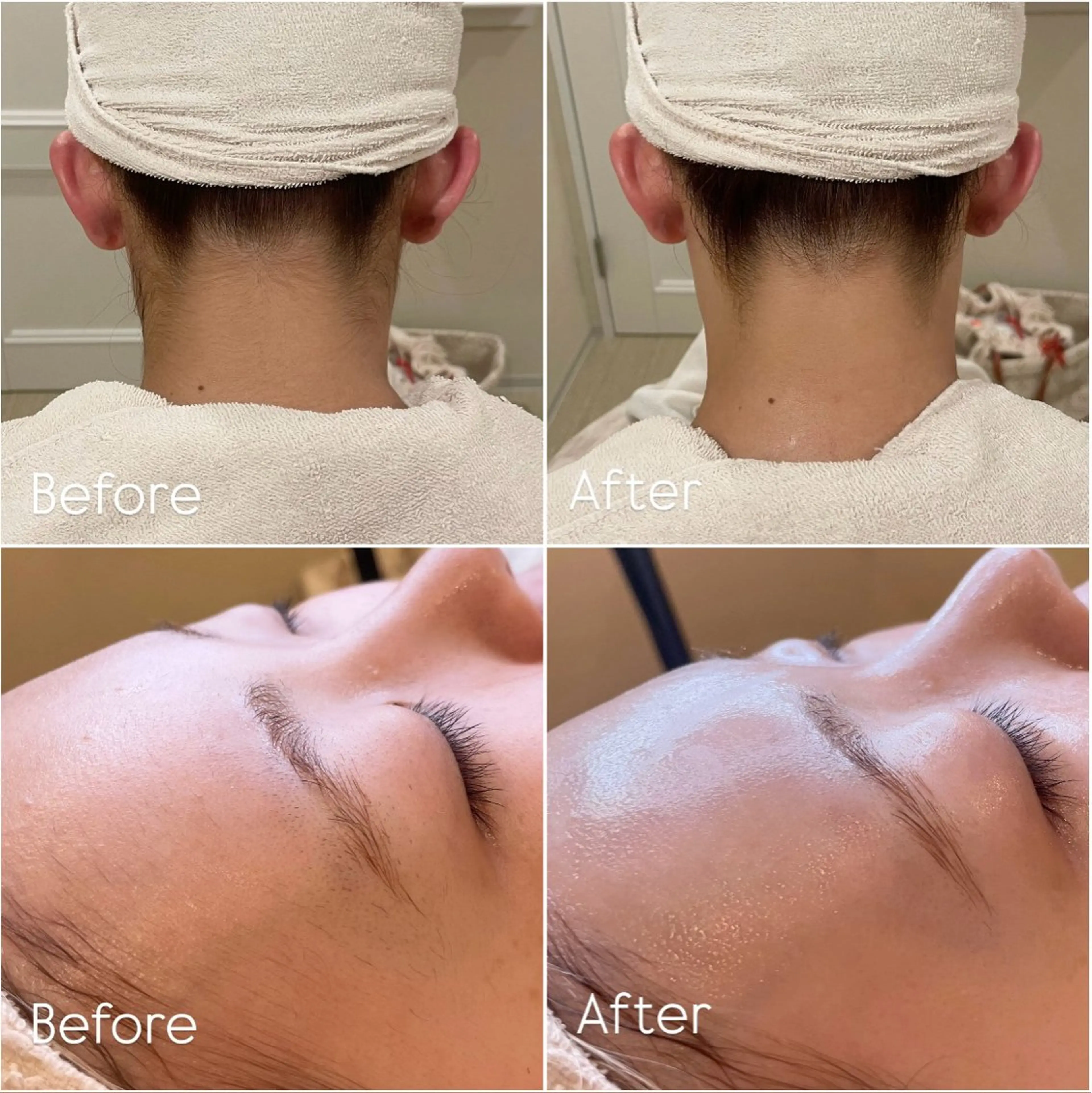 💎フェイス＆うなじシェービング💎の写真