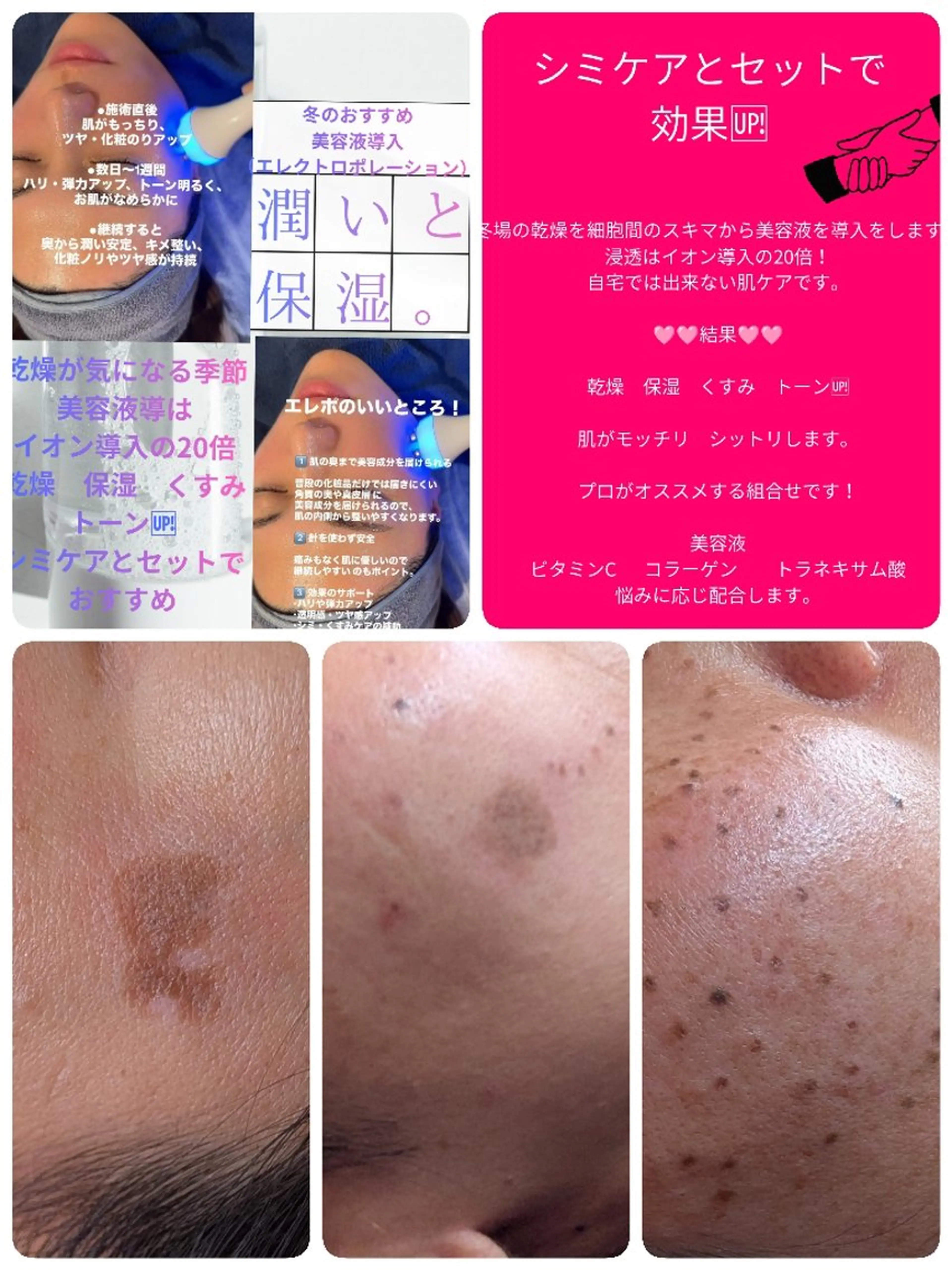 SPOT.com  シミケア専門店のエステ・リラクイメージ