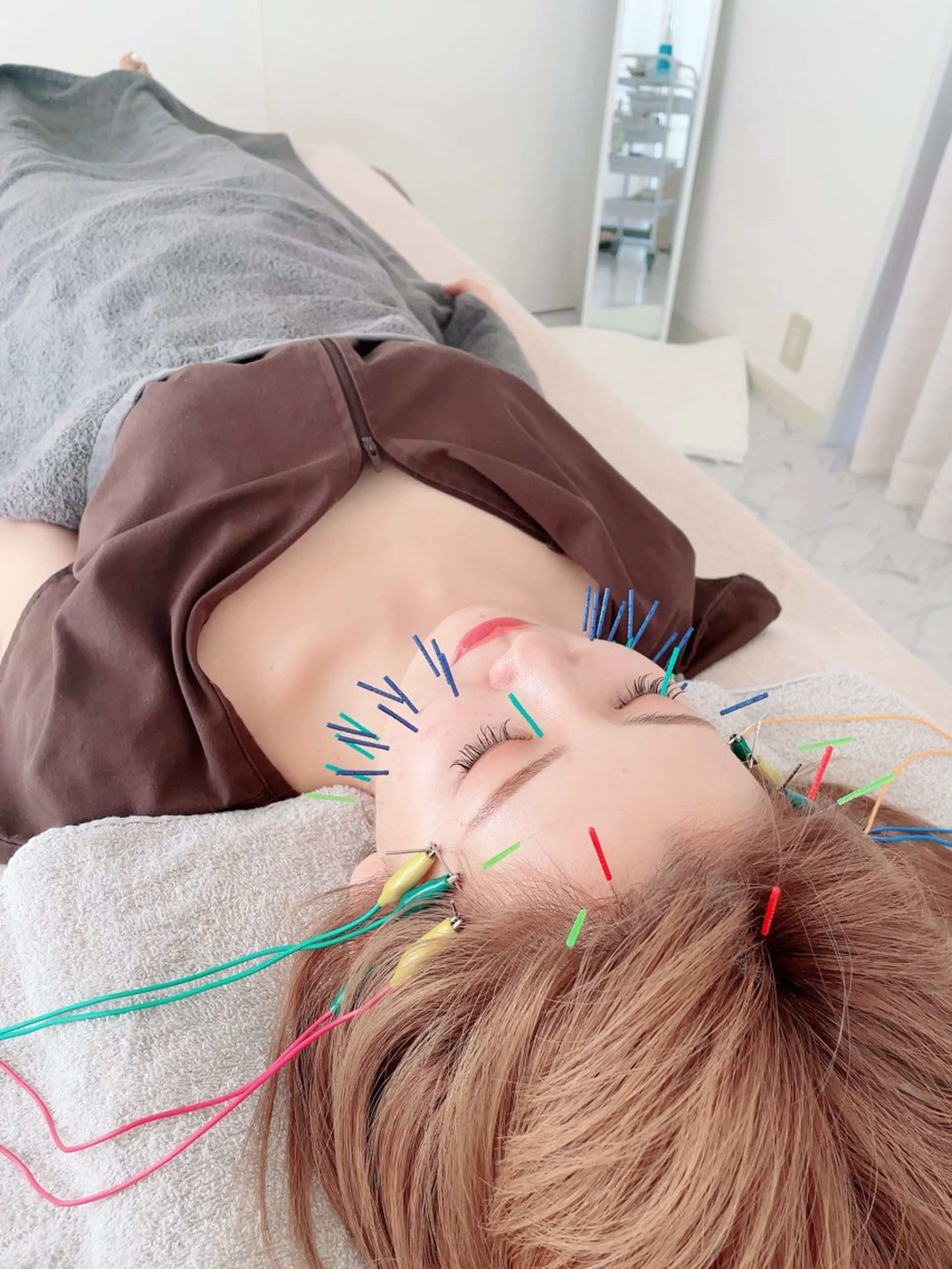 【❤️‍🔥顔も体も同時に❤️‍🔥】トータルケアカスタム美鍼灸　75minの写真