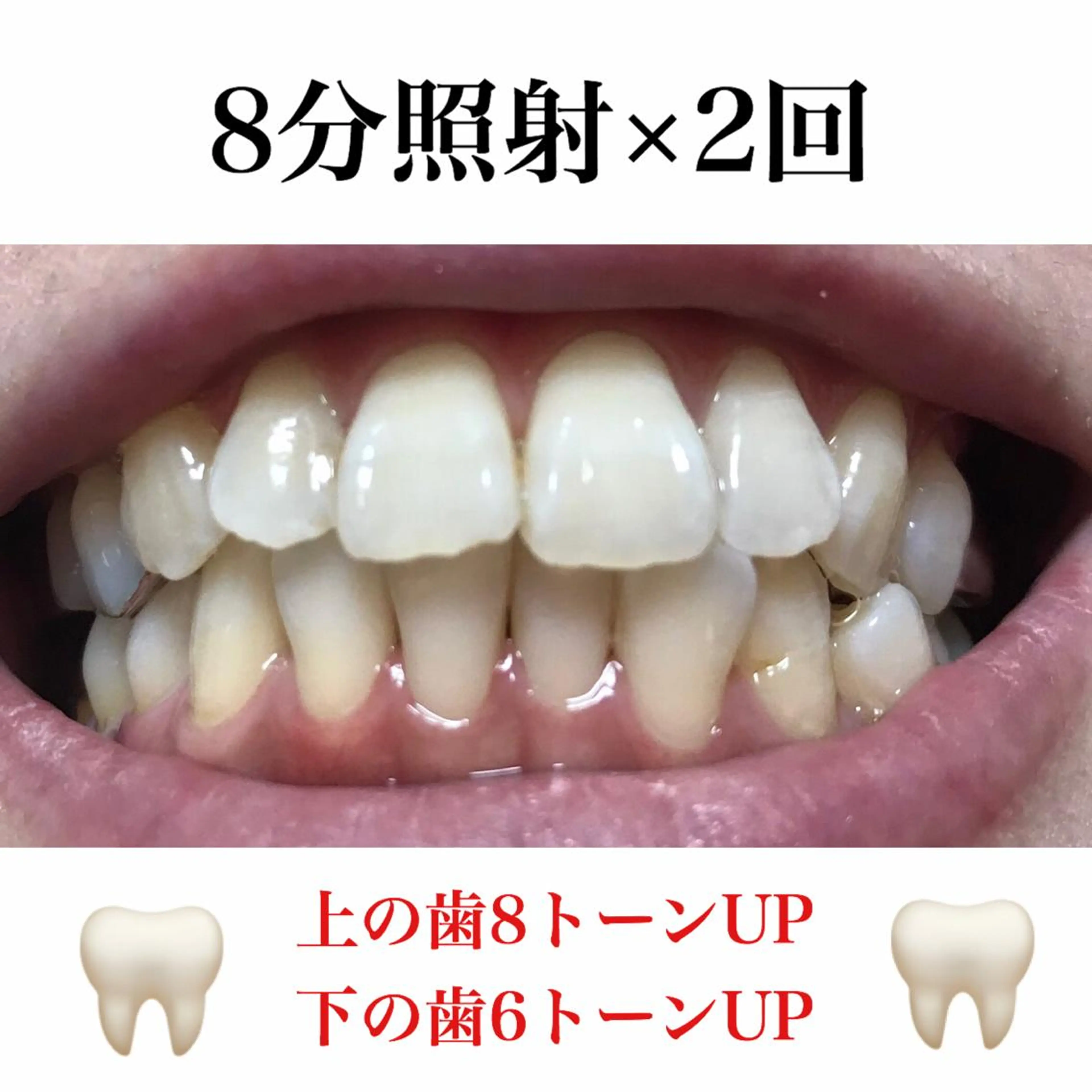 ネイル/耳つぼ /新ホワイトニングのネイルデザイン