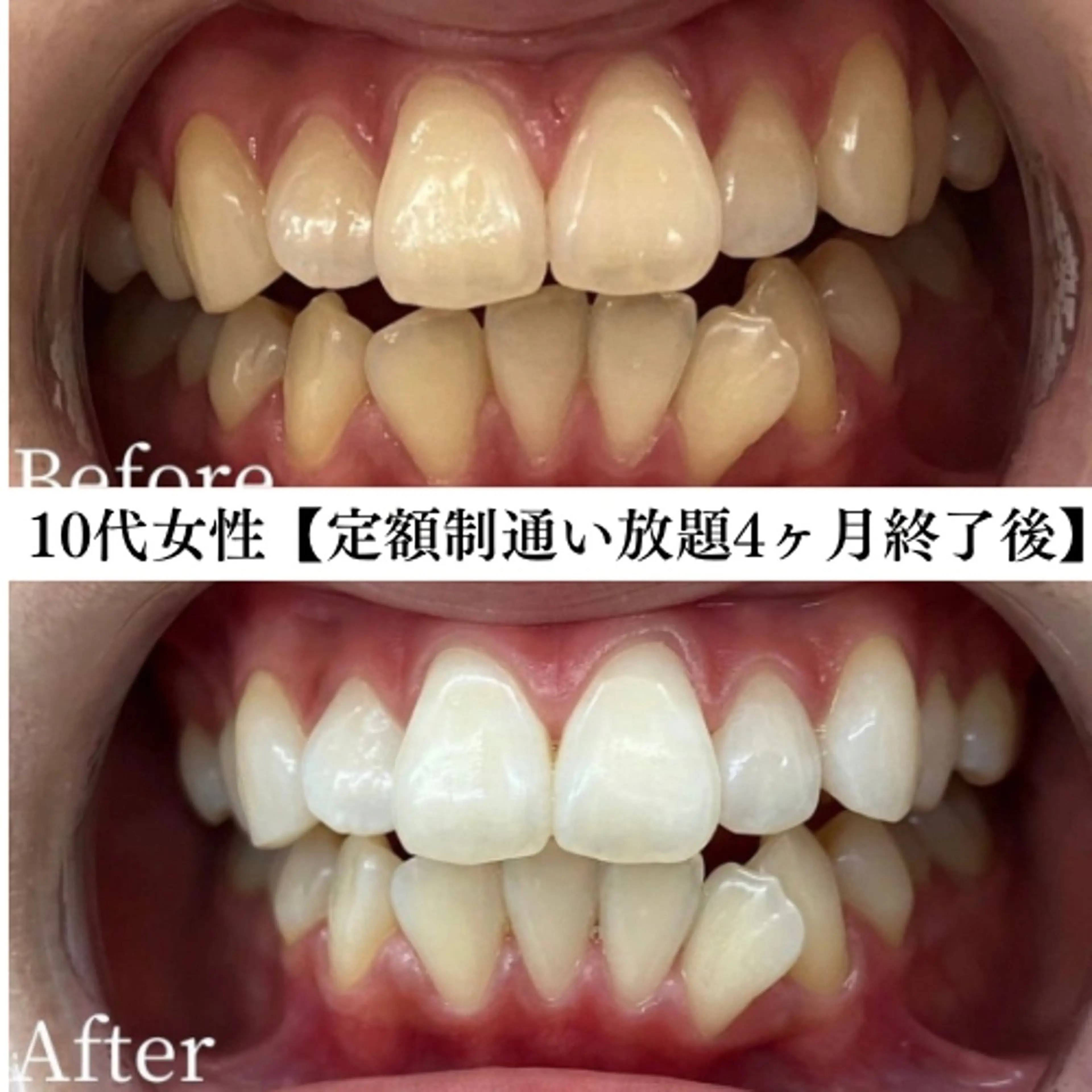 キッズ メンズ エステ リラク セルフホワイトニング専門店WHITE福岡天神店所属・セルフホワイト専門店 WHITE福岡天神店のエステ・リラクイメージ