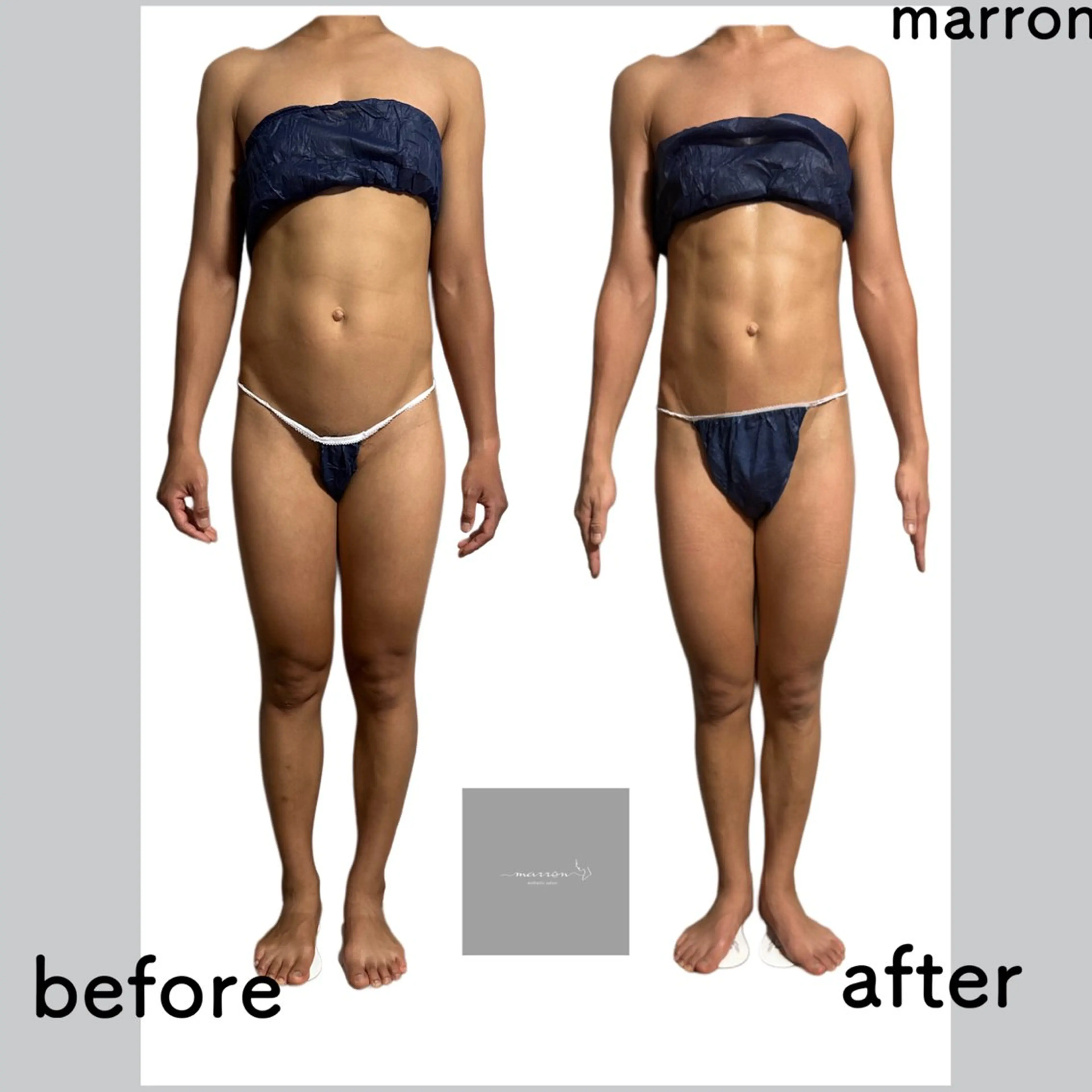 marron所属・痩身ハイパーナイフ ララピールリアボーテのエステ・リラクイメージ