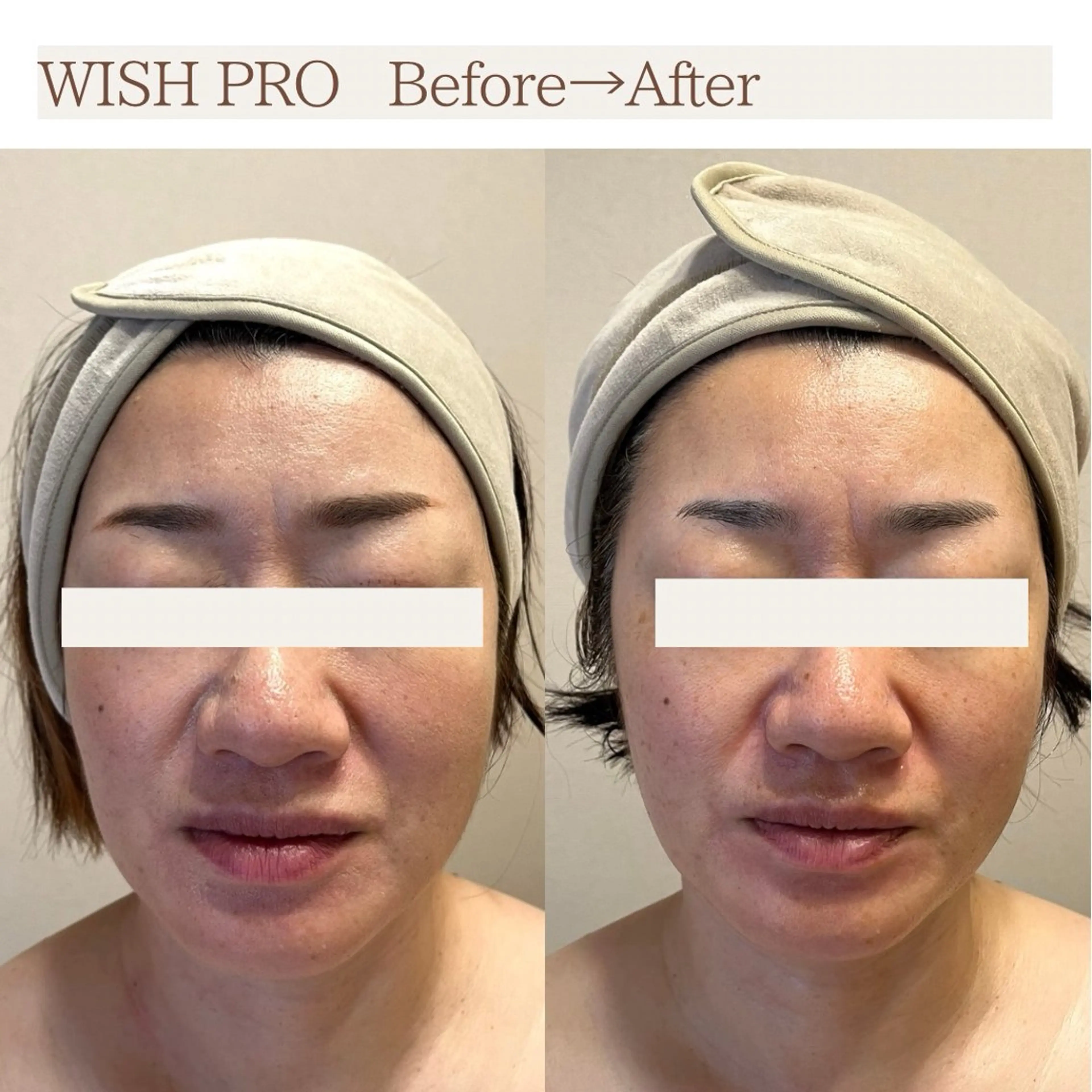 Total Beauty salon Bloom所属・肌育WISHpro 専門サロンBloomのエステ・リラクイメージ