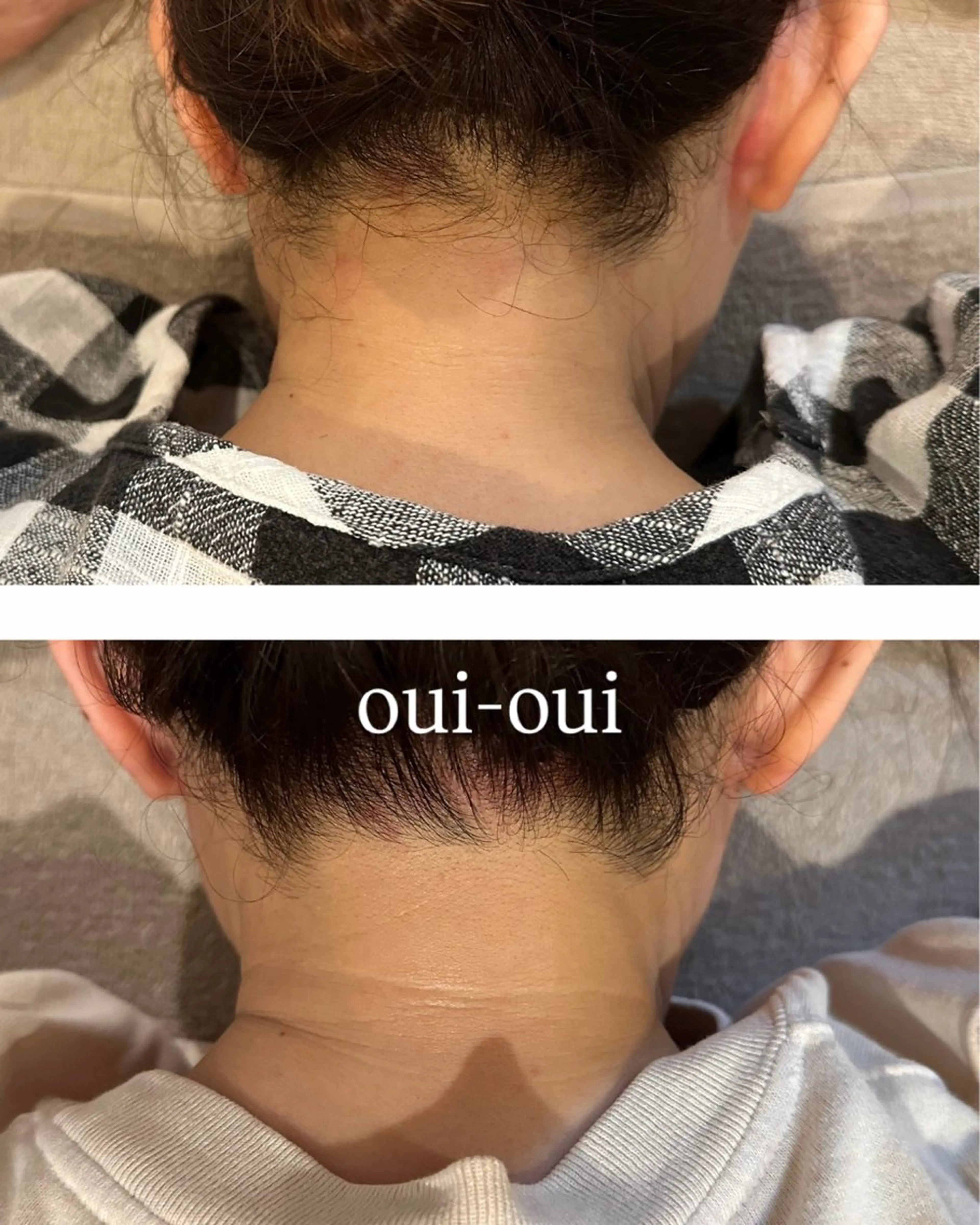 oui-oui　ウィウィ所属・oui-oui 磐田脱毛のエステ・リラクイメージ