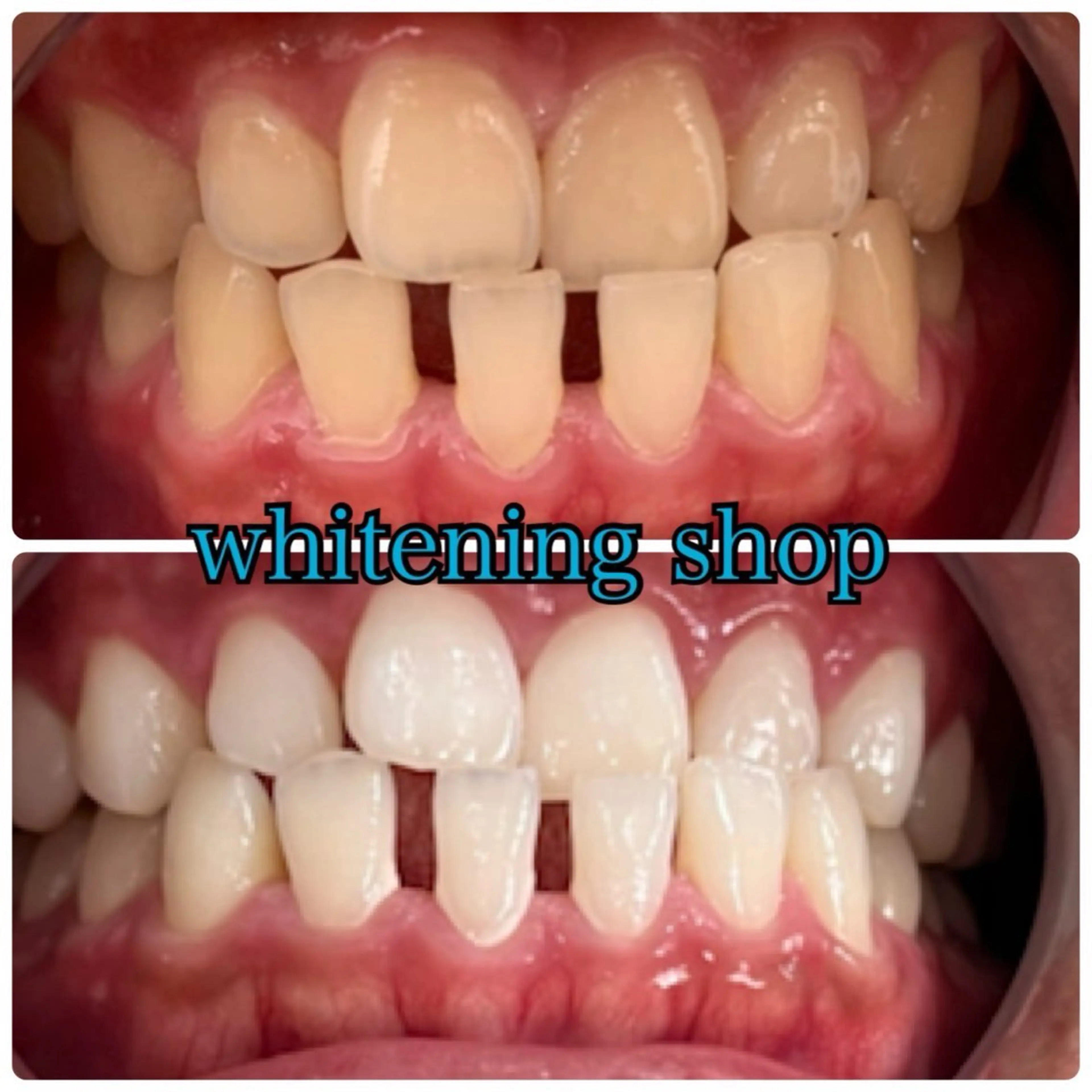 メンズ エステ リラク ホワイトニング ショップ川越店のエステ・リラクイメージ