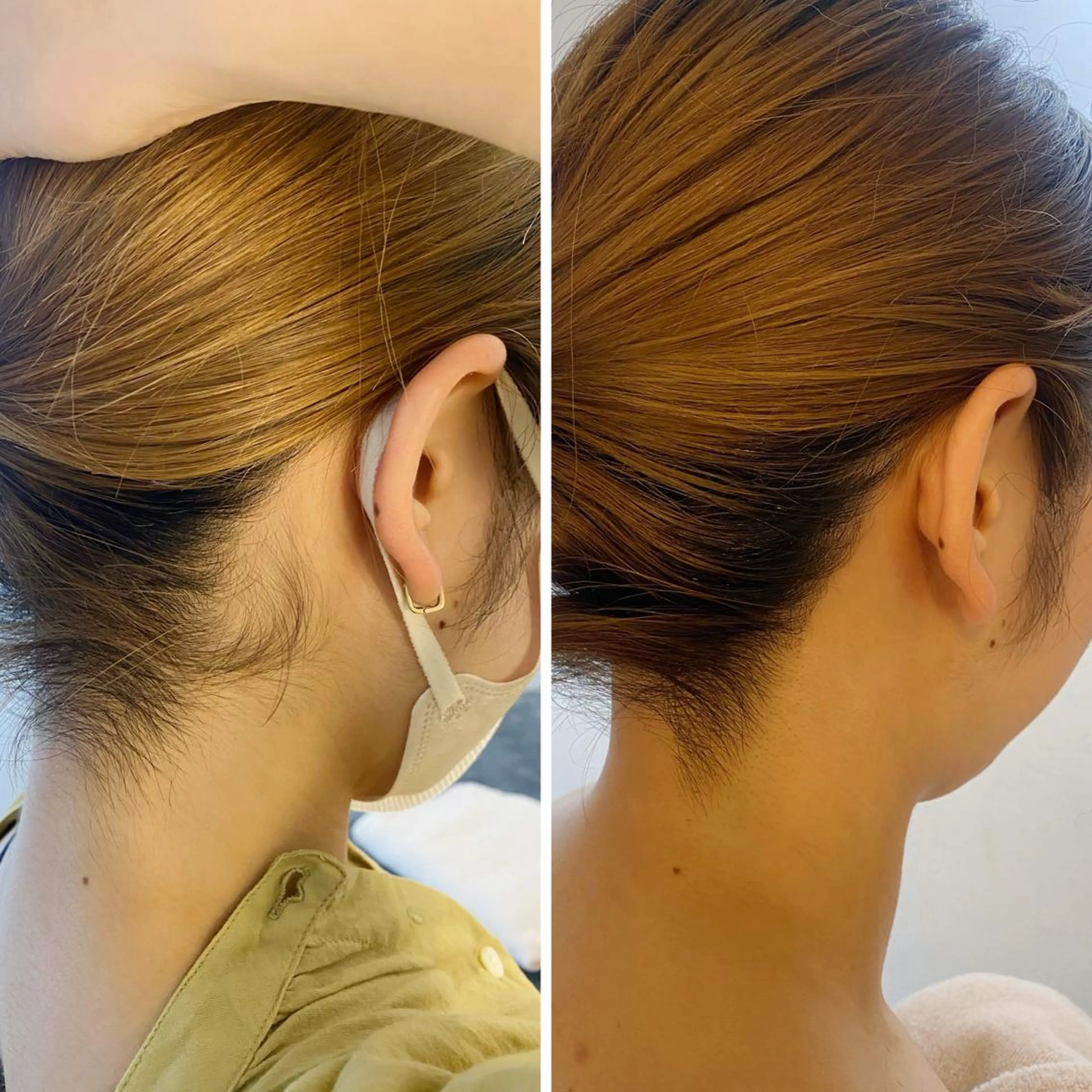 脱毛 うなじ脱毛/美肌脱毛 LABELのエステ・リラクイメージ