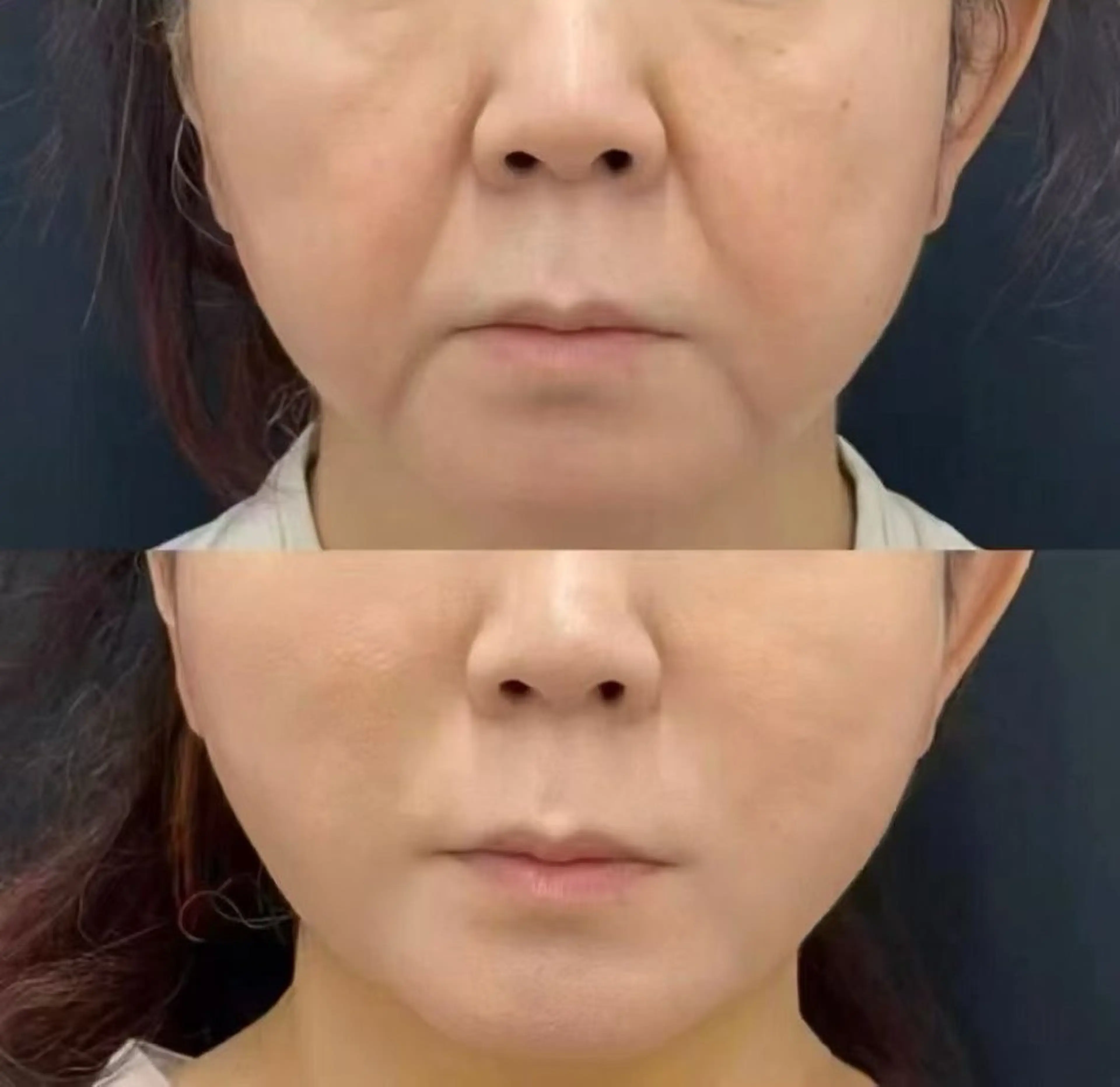 マツエク・マツパ エステ aliaハイフ&水光ジェットサロン所属・aliaハーブ水光店 エステティシャン募集のエステ・リラクイメージ