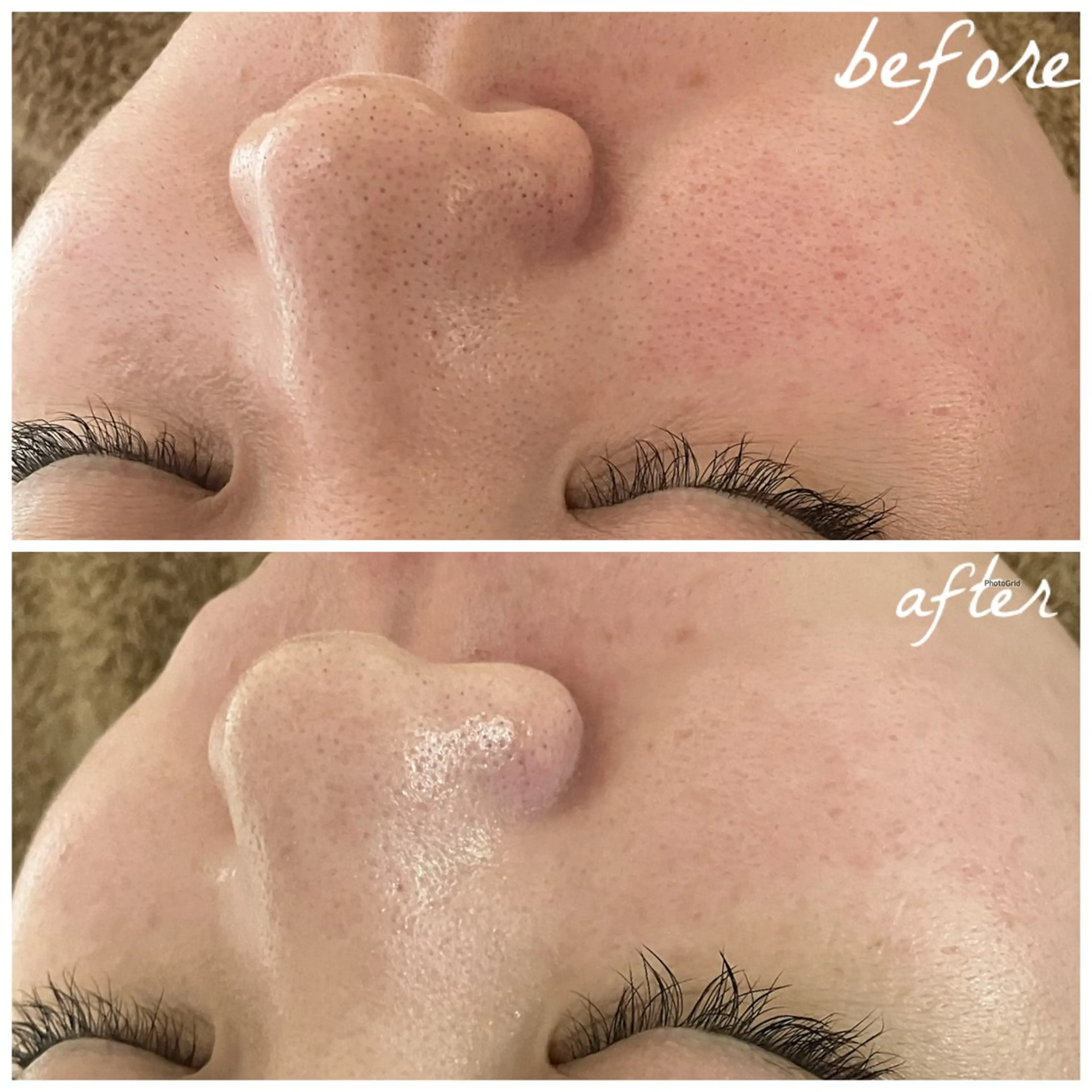 メンズ エステ メナード岐阜茜部 杉浦のエステ・リラクイメージ