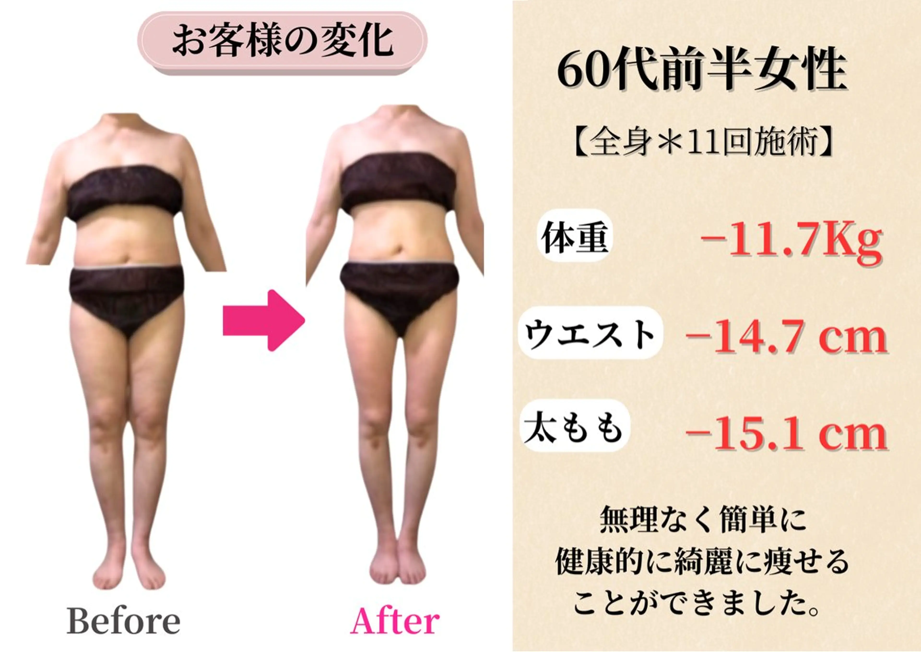 エステ Belle White所属・本格痩身＊肌質改善＊ BelleWhiteのエステ・リラクイメージ