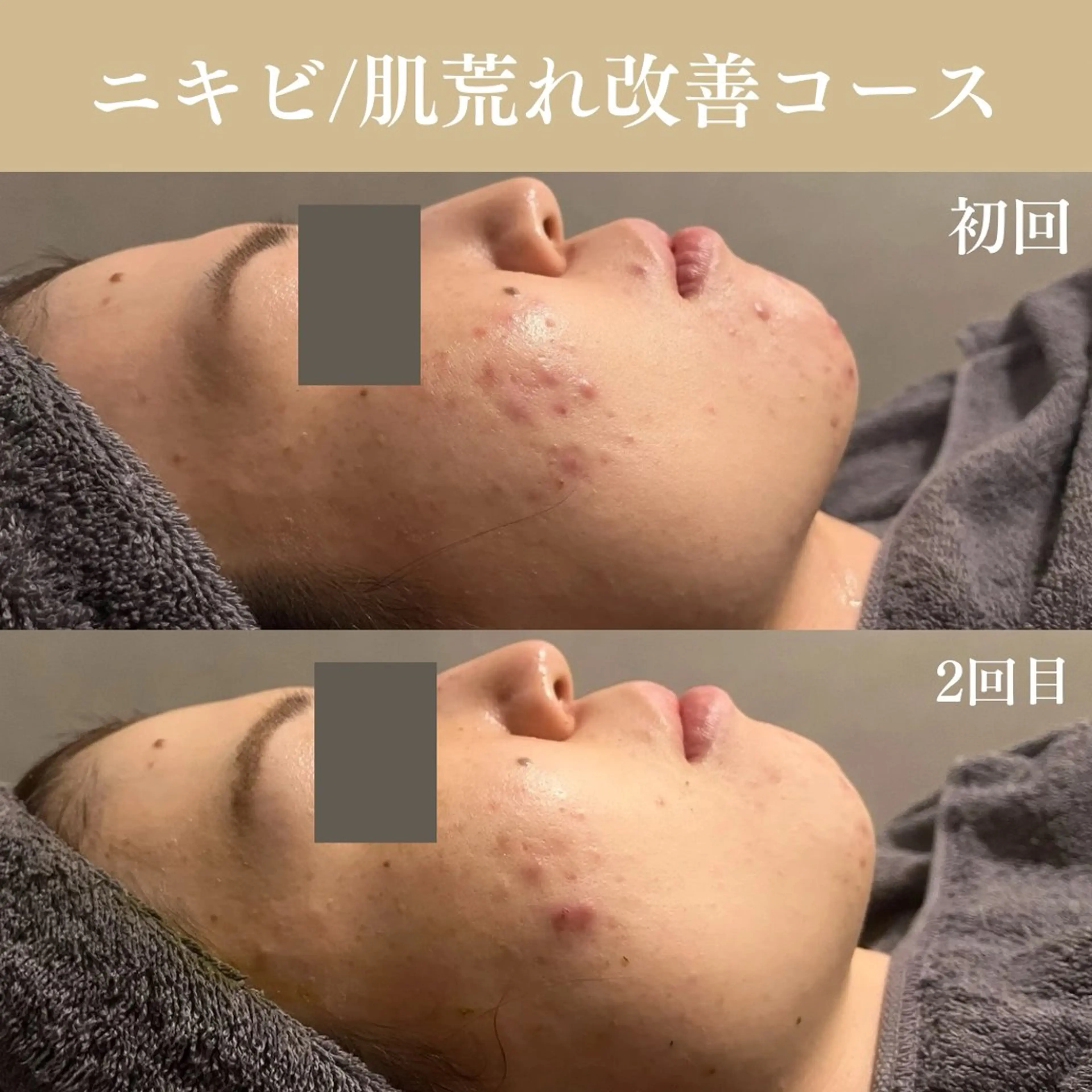 Oncebell. Bodymake&beautysalon所属・Oncebell. ワンベルのエステ・リラクイメージ