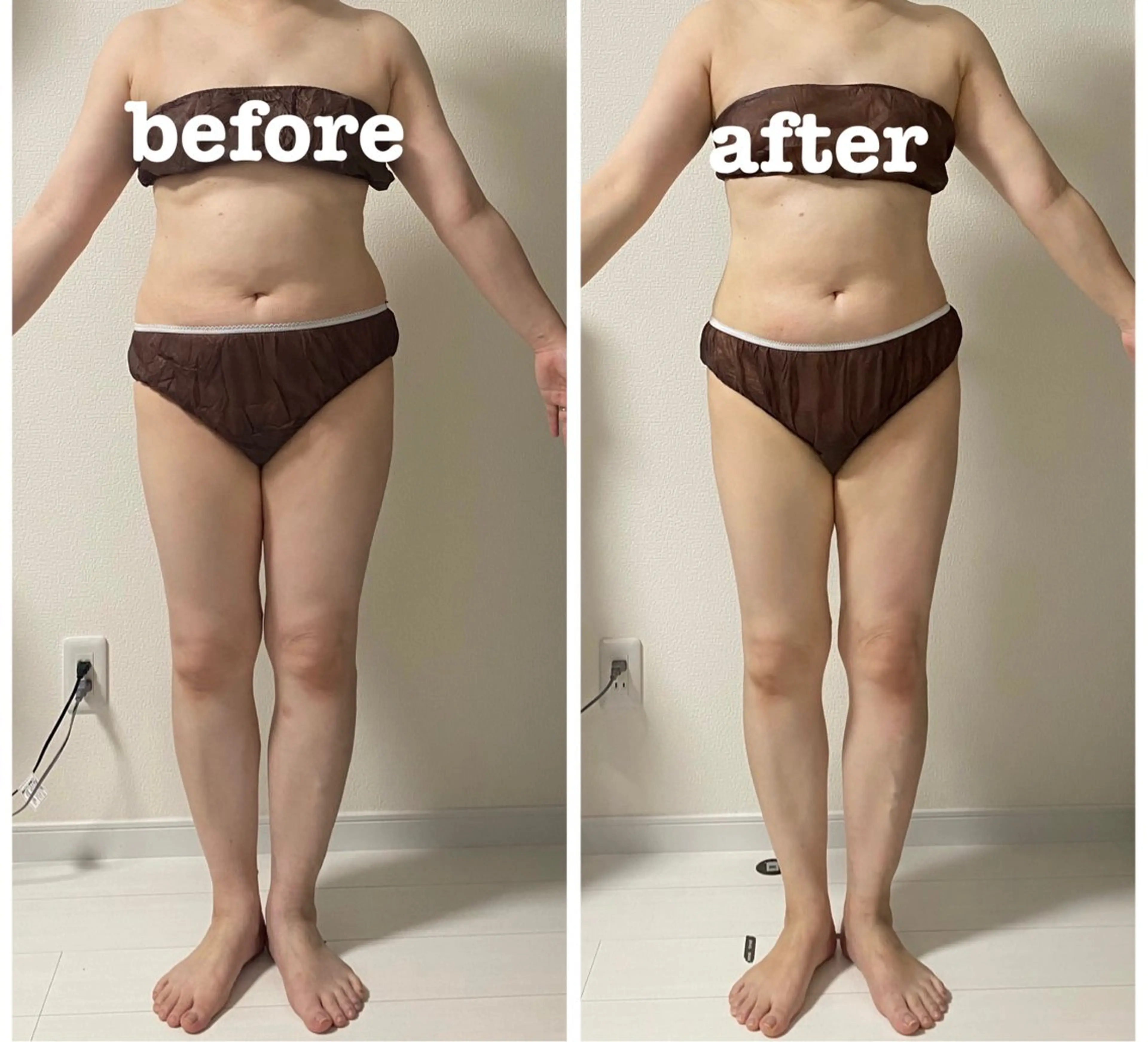 【痩身】【全身】最高級マシン！切らない脂肪吸引！ZERO CRASHの写真