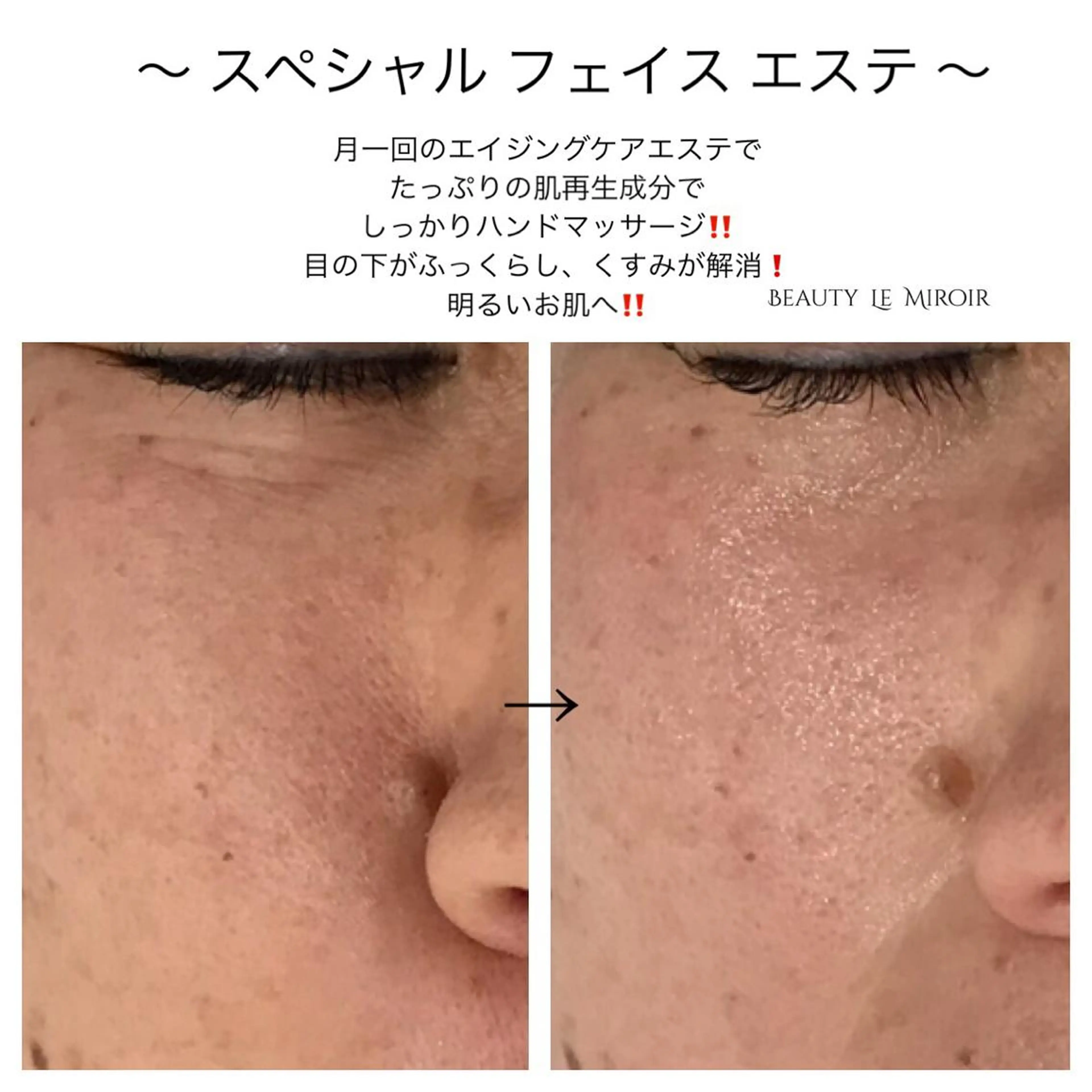 ビューティー ミロワールのエステ・リラクイメージ