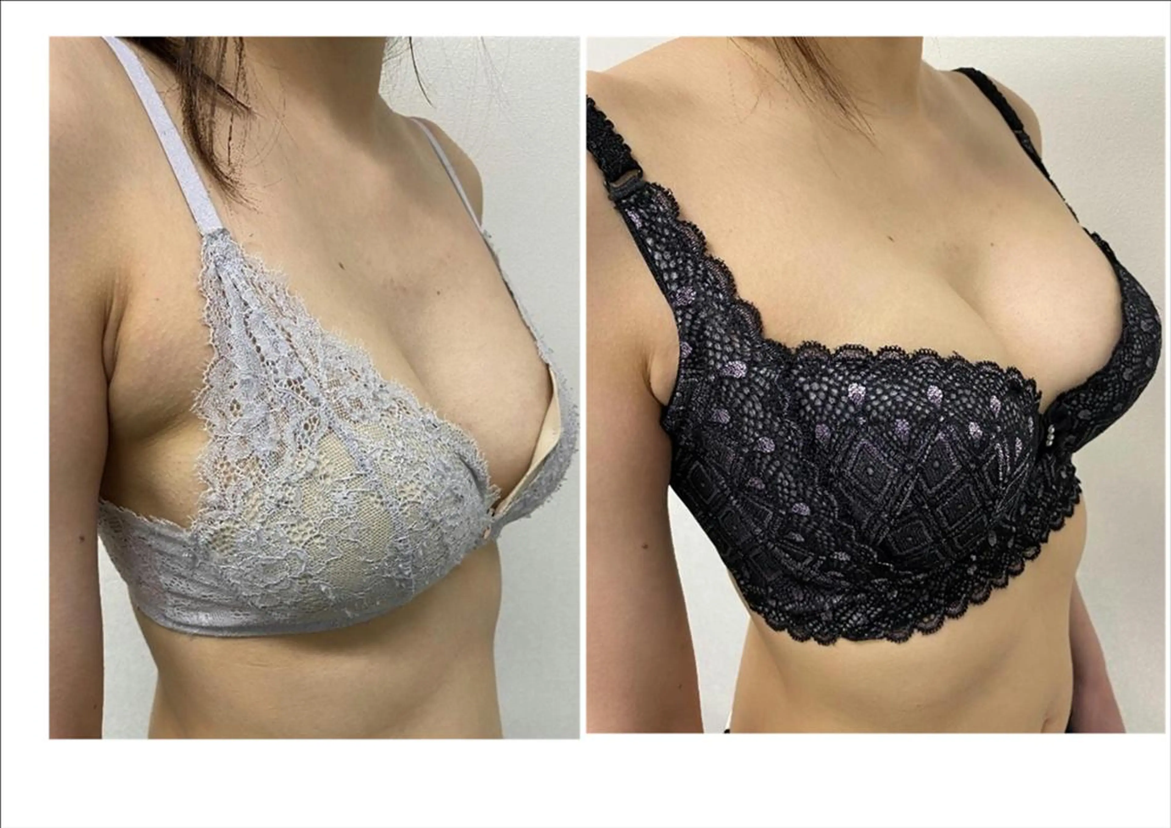 U25クーポン💕バストケアと同時に肩こり・姿勢矯正で理想のボディライン🏋️‍♀️✨谷間育成ボリュームバストメイク❕の写真