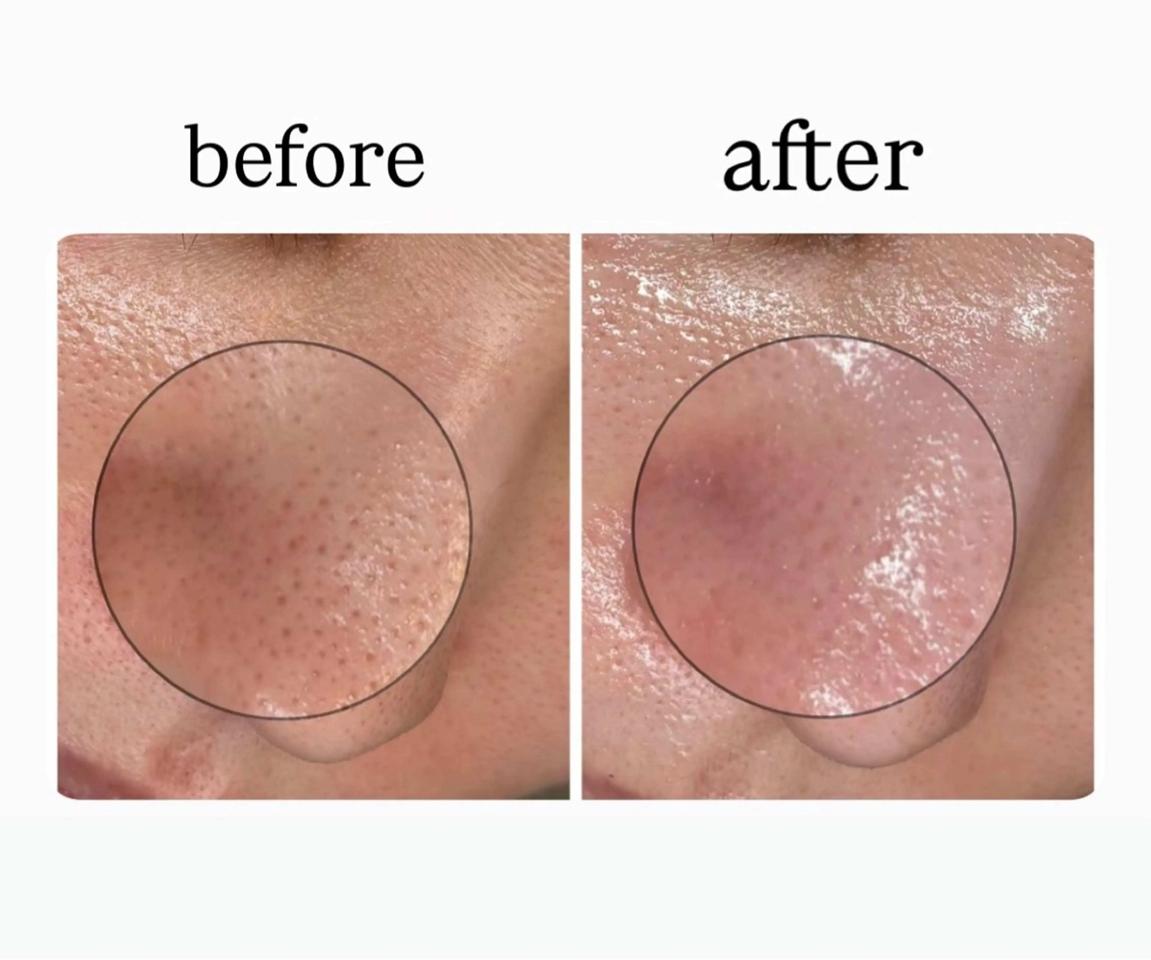 その他 Salon【yuzu.】ﾕｽﾞﾄﾞｯﾄ所属・🌿肌管理×美眉 yuzu.の眉毛・アイブロウイメージ