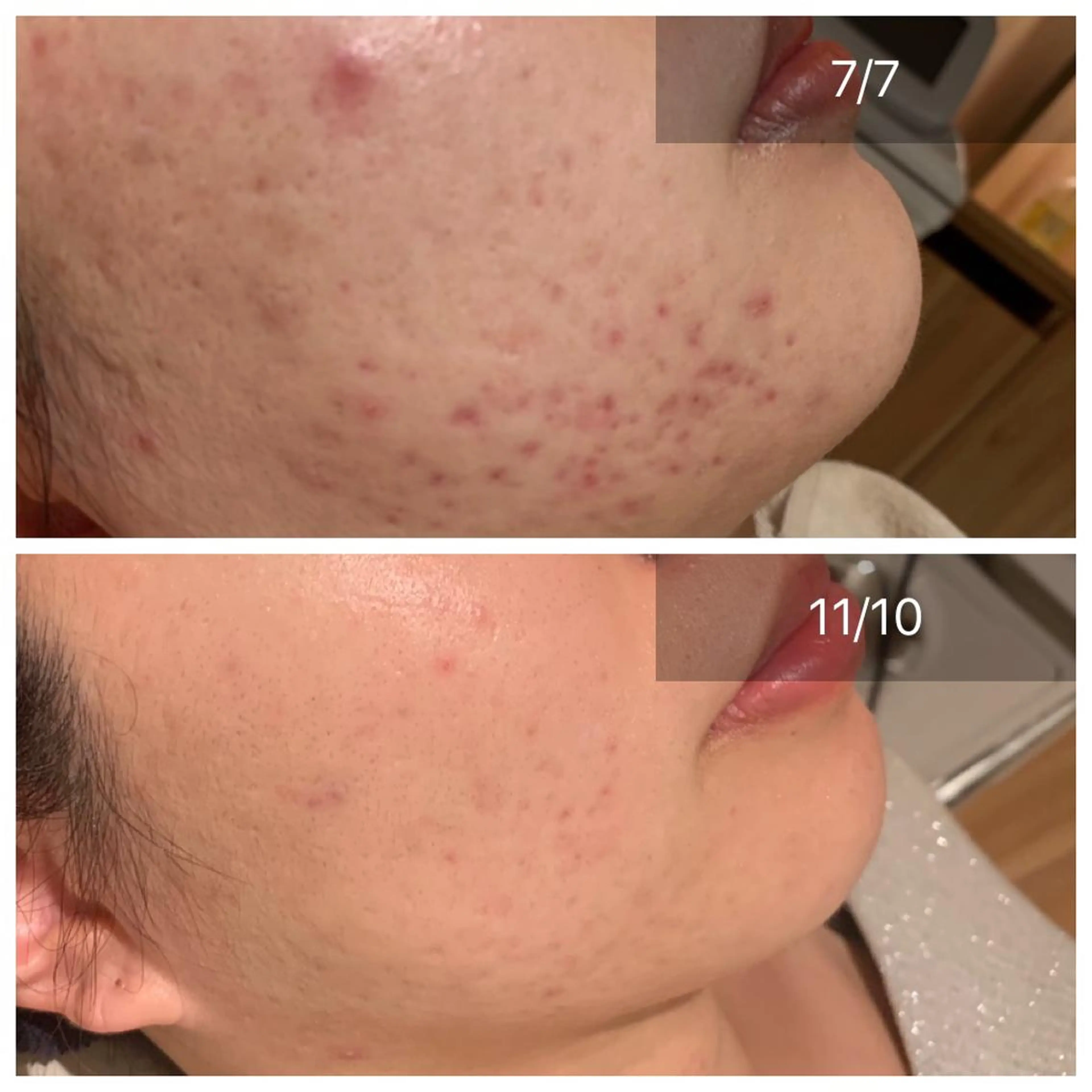 エステ CHERIE所属・CHERIE Hisadaのエステ・リラクイメージ