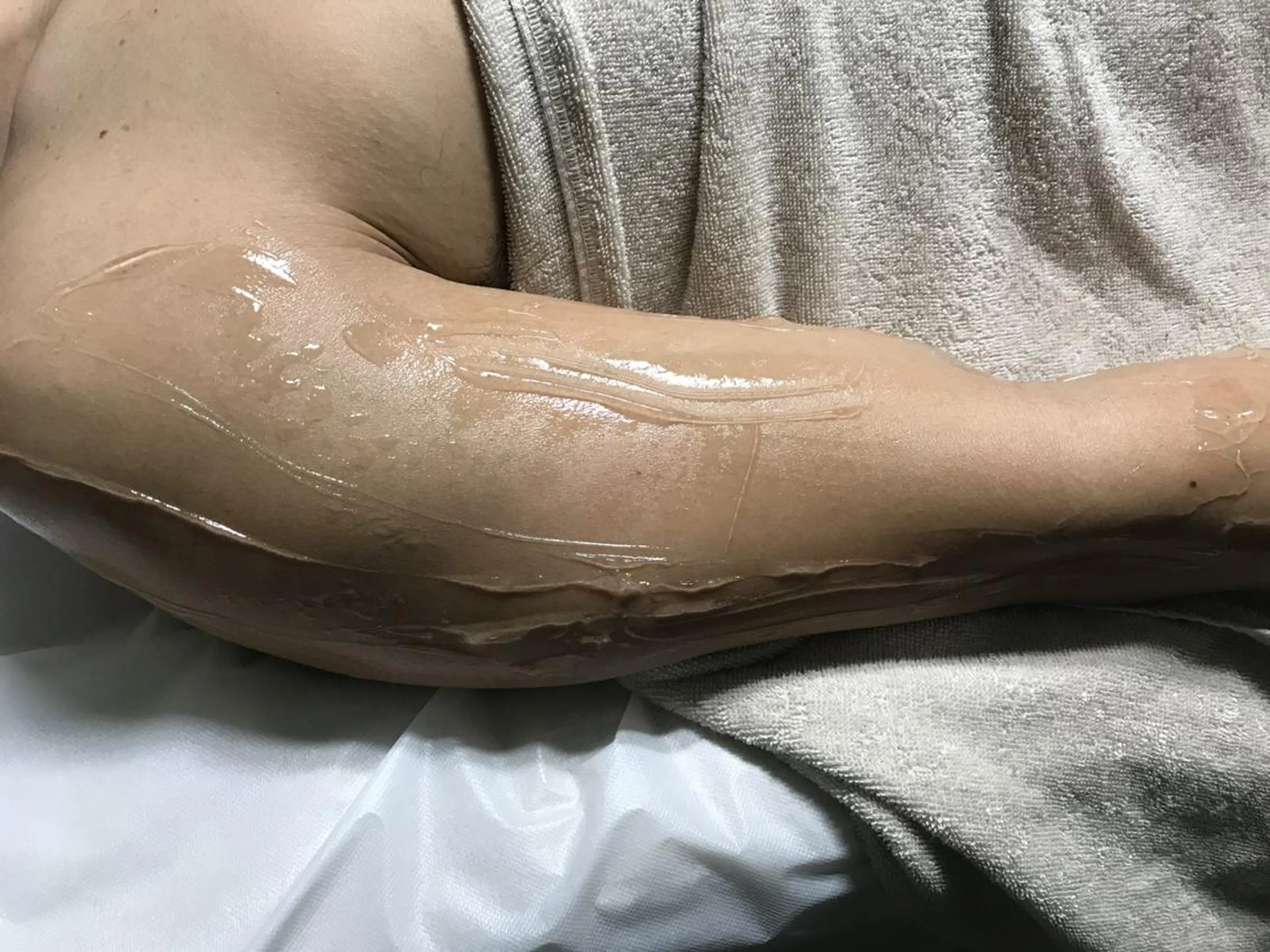 メンズ マンモス脱毛 札幌白石店のその他イメージ