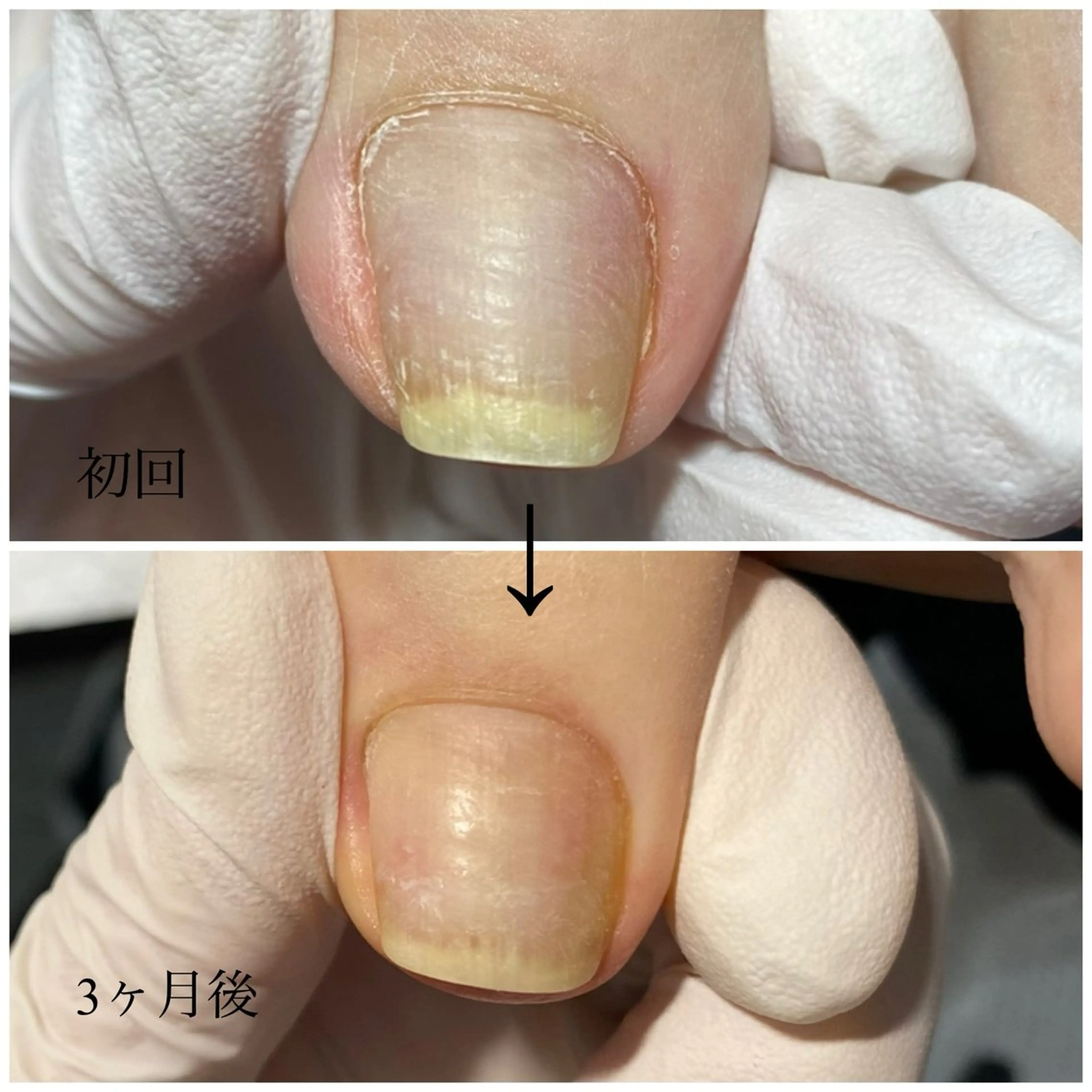 ネイル N.design muraのネイルデザイン