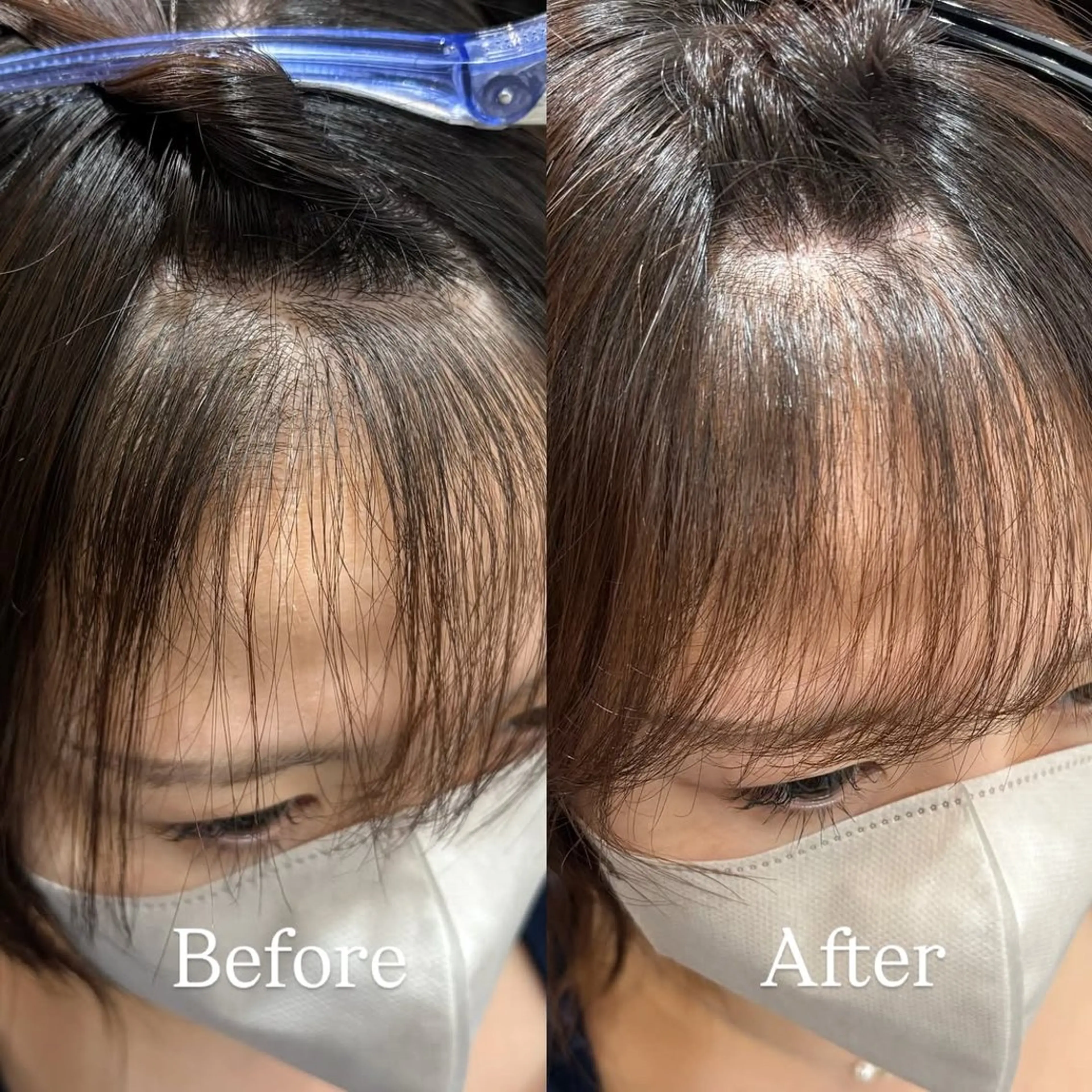 ミディアム パーマ ミディアムパーマ カット パーマ 縮毛矯正 【お洒落パーマ】 Elme　肥塚康汰郎のヘアスタイル