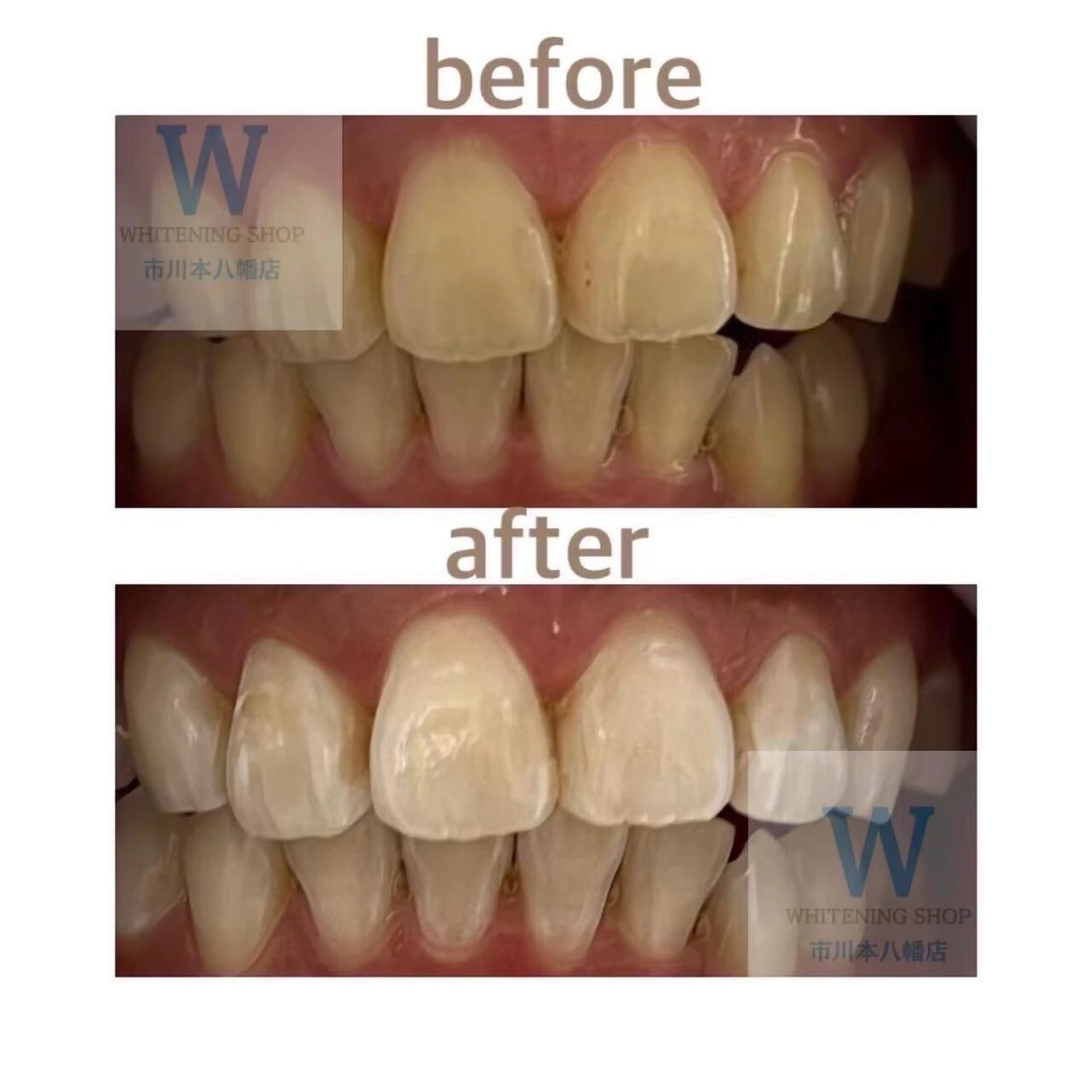 ホワイトニング ショップ本八幡店のエステ・リラクイメージ