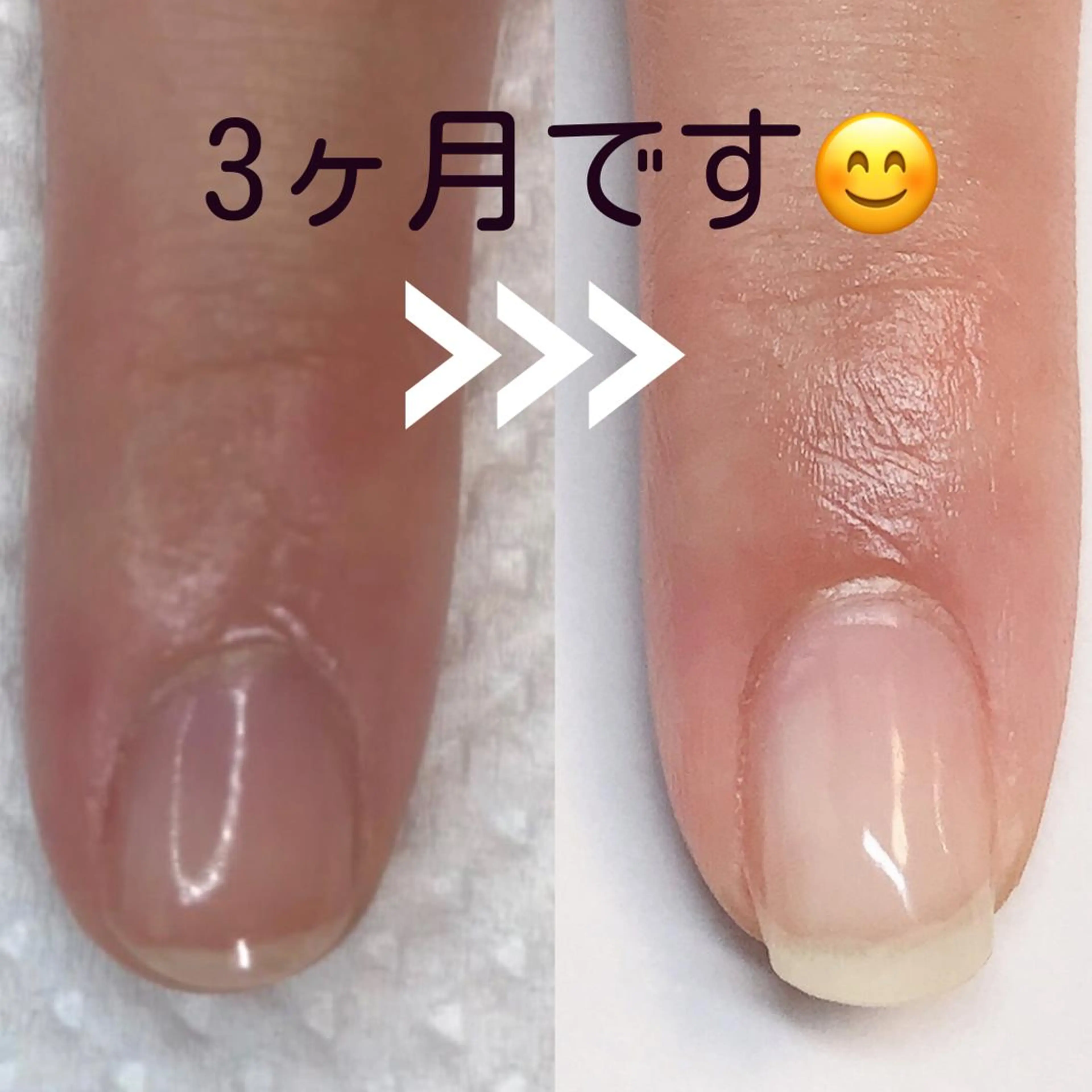 急募☆自爪育成モデル募集♪初回育成オイル込み/２回目以降¥6,600/✨☺️の写真