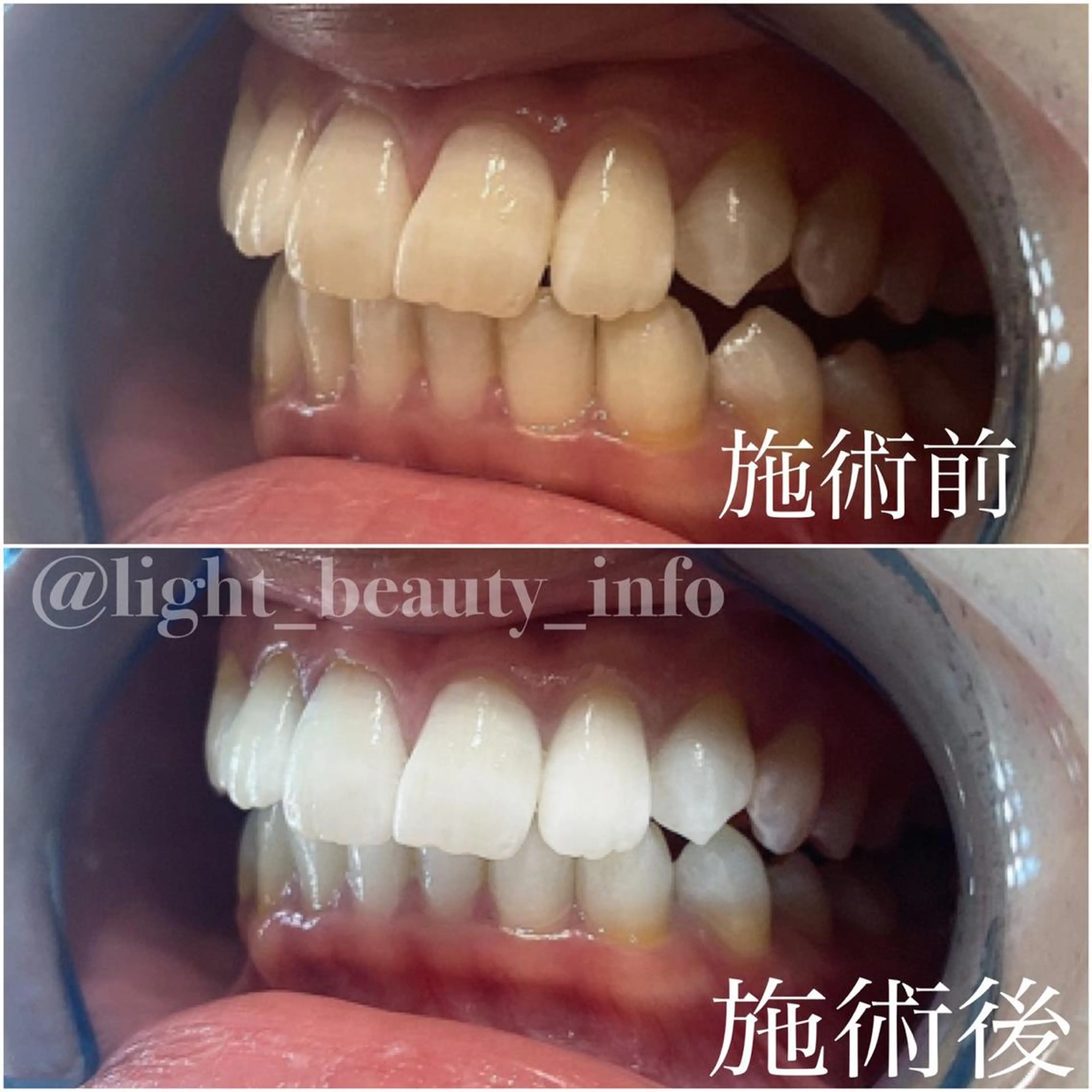 ライトビューティー 銀座店のエステ・リラクイメージ