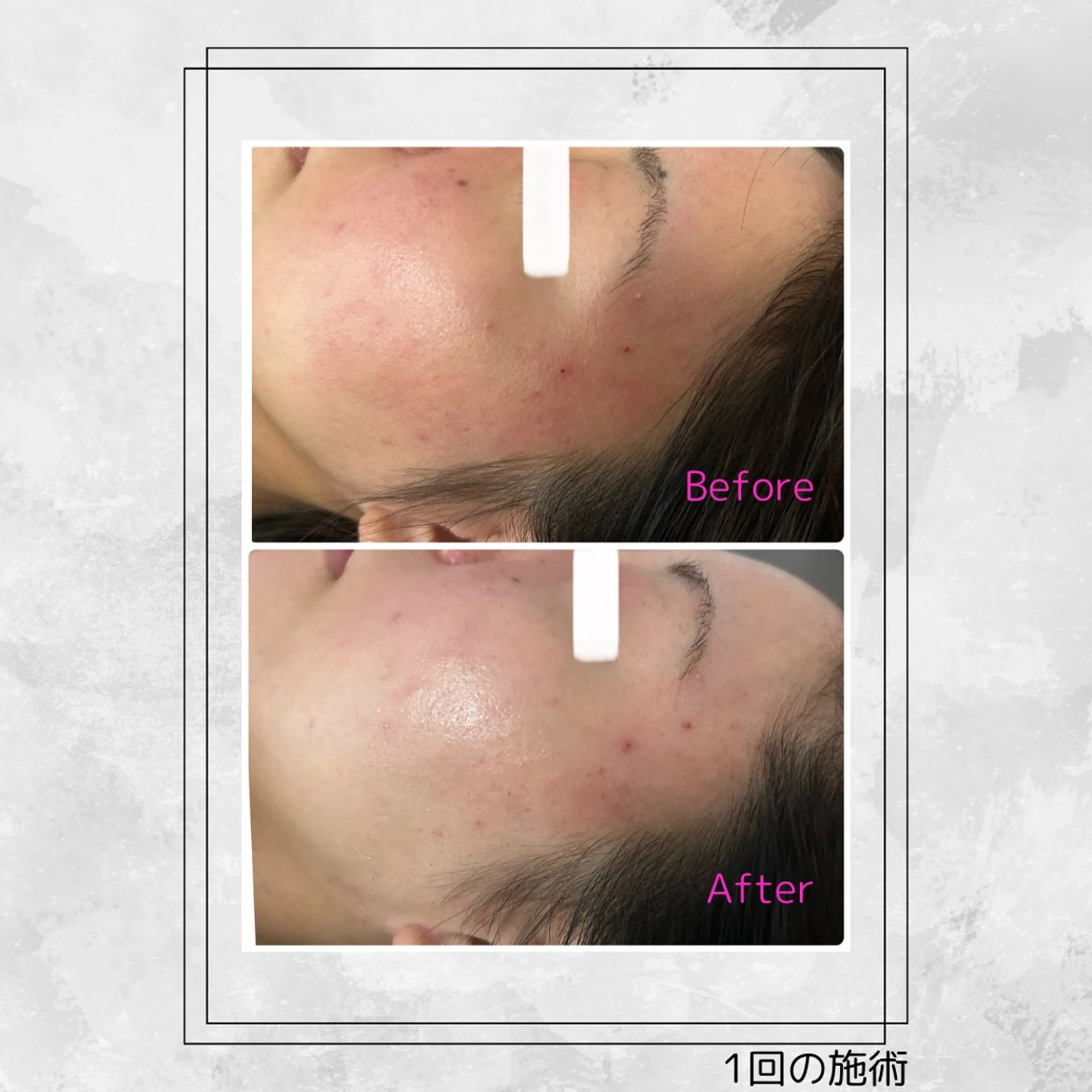 エステ Bijou+幸手店所属・ビジュープラス幸手 由美のエステ・リラクイメージ