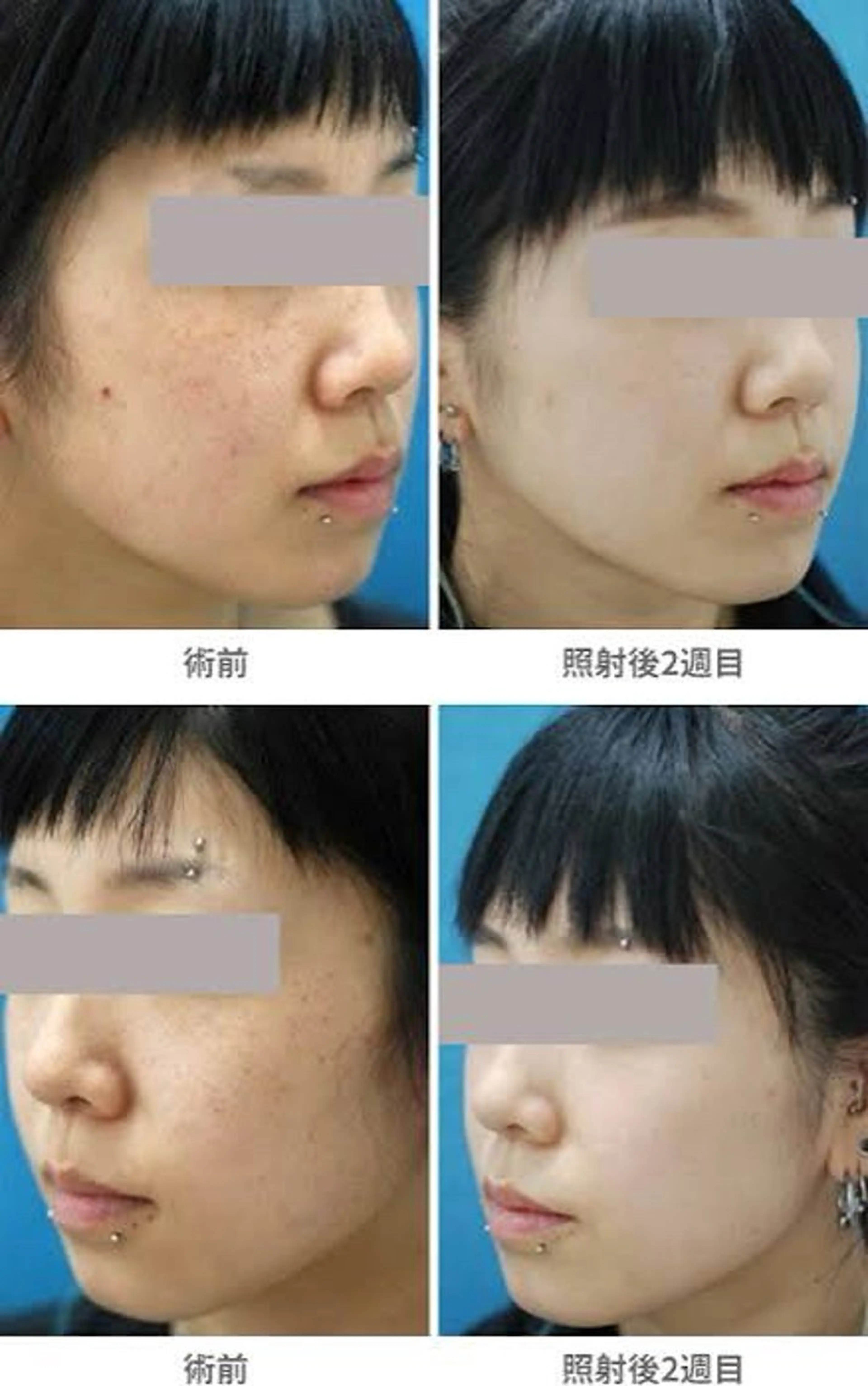 IPFフォトショットの写真