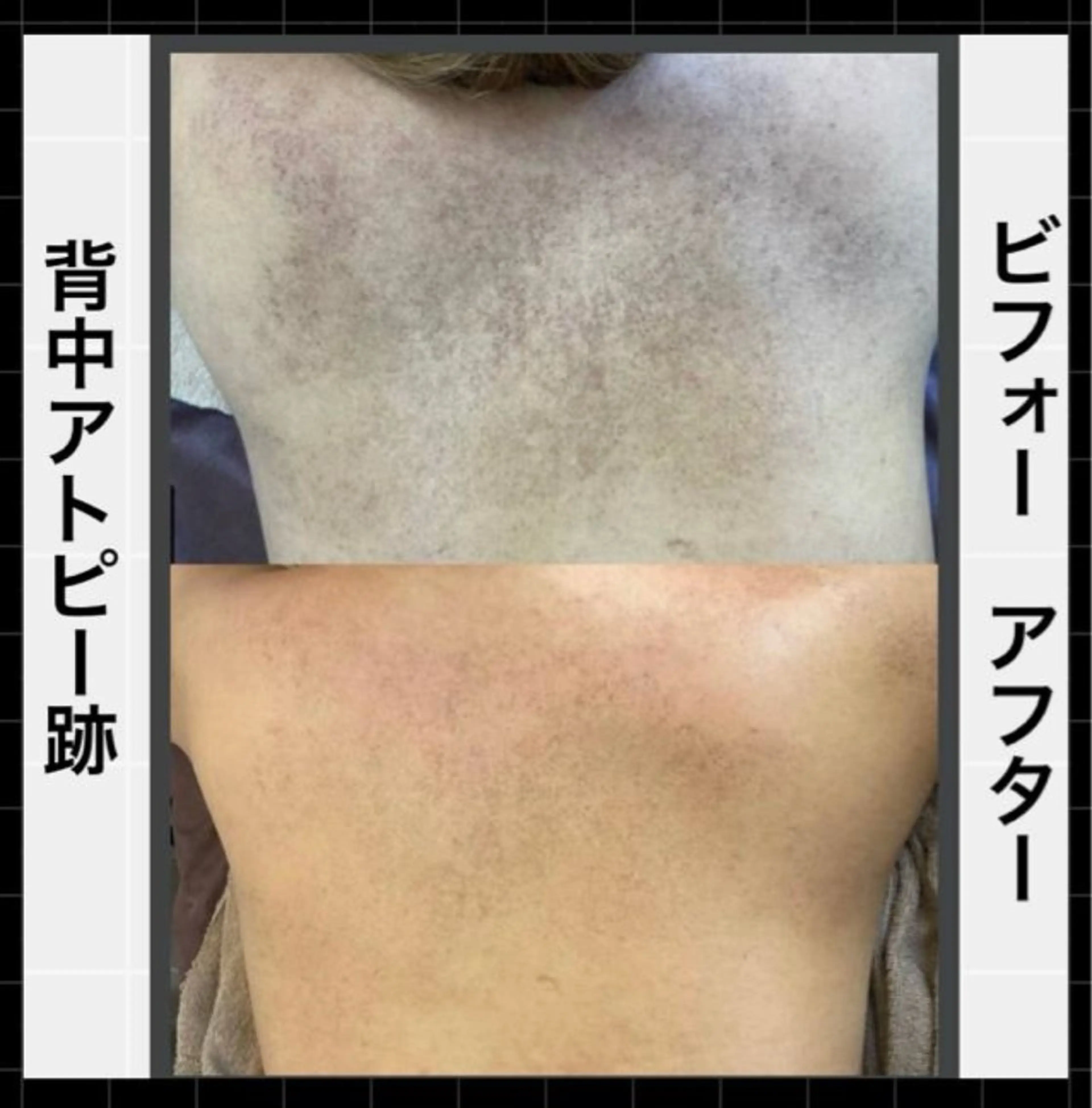 エステ ハーブピーリング 専門店MOKA所属・ハーブピーリング専門 MOKAのエステ・リラクイメージ