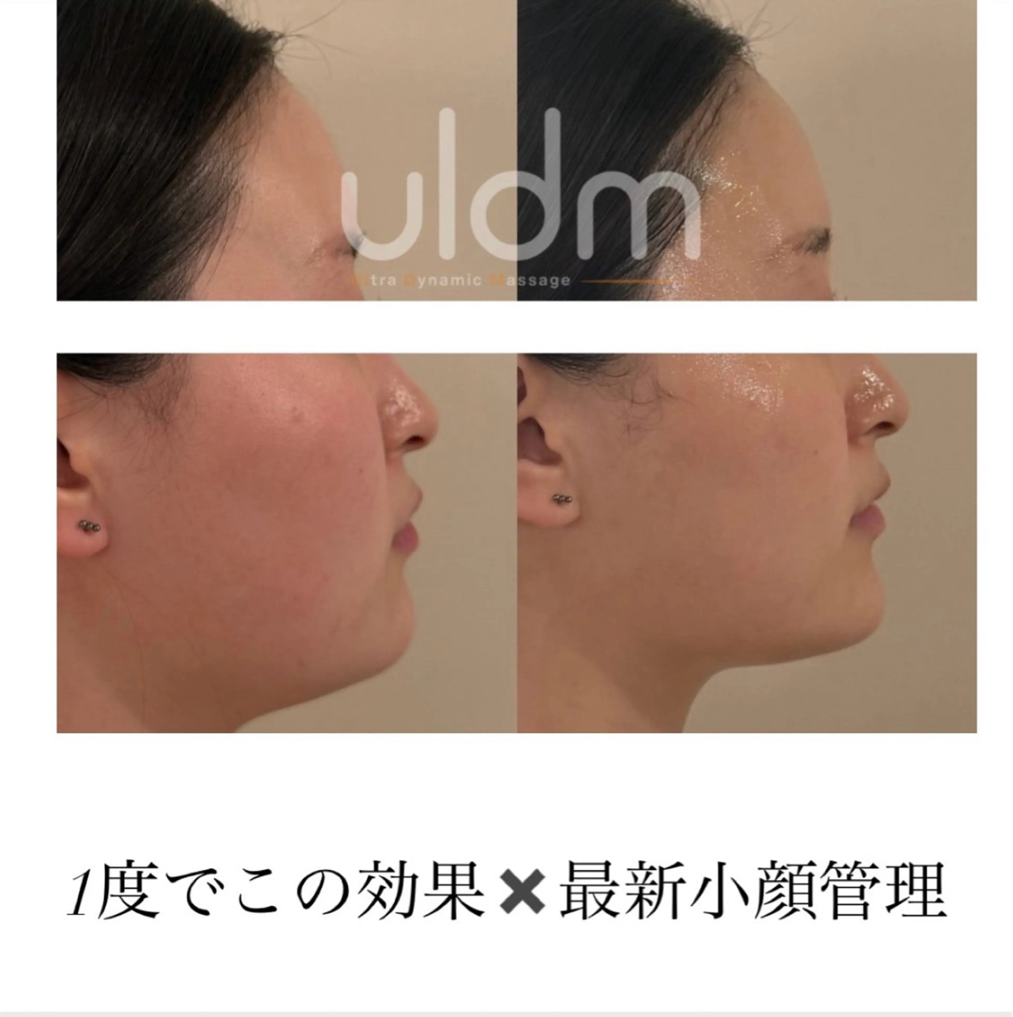 エステ crescent所属・【韓国肌管理・脱毛】 クレセントのエステ・リラクイメージ