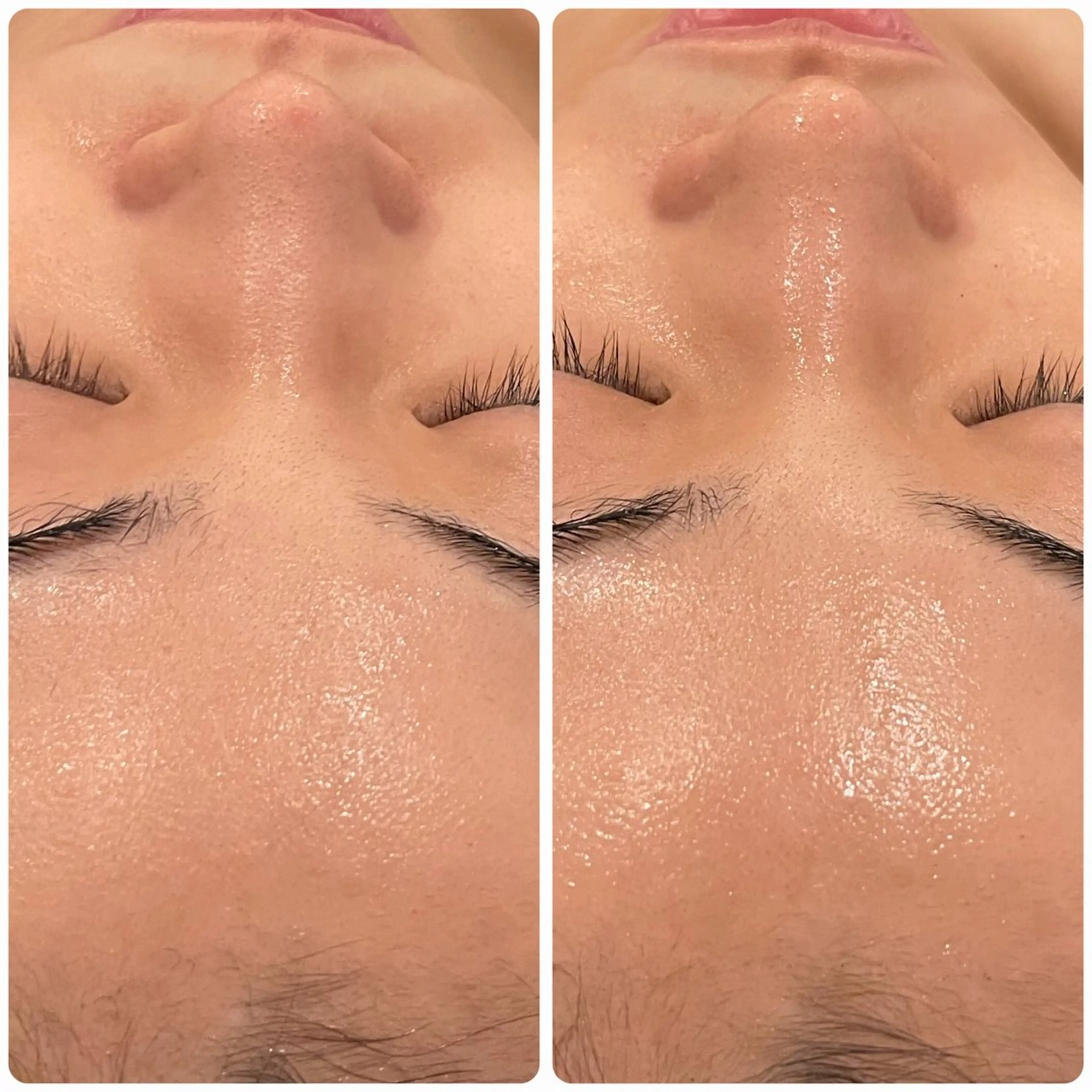 立体小顔×艶肌×美ボ ディ似合わせ施術 岡のエステ・リラクイメージ