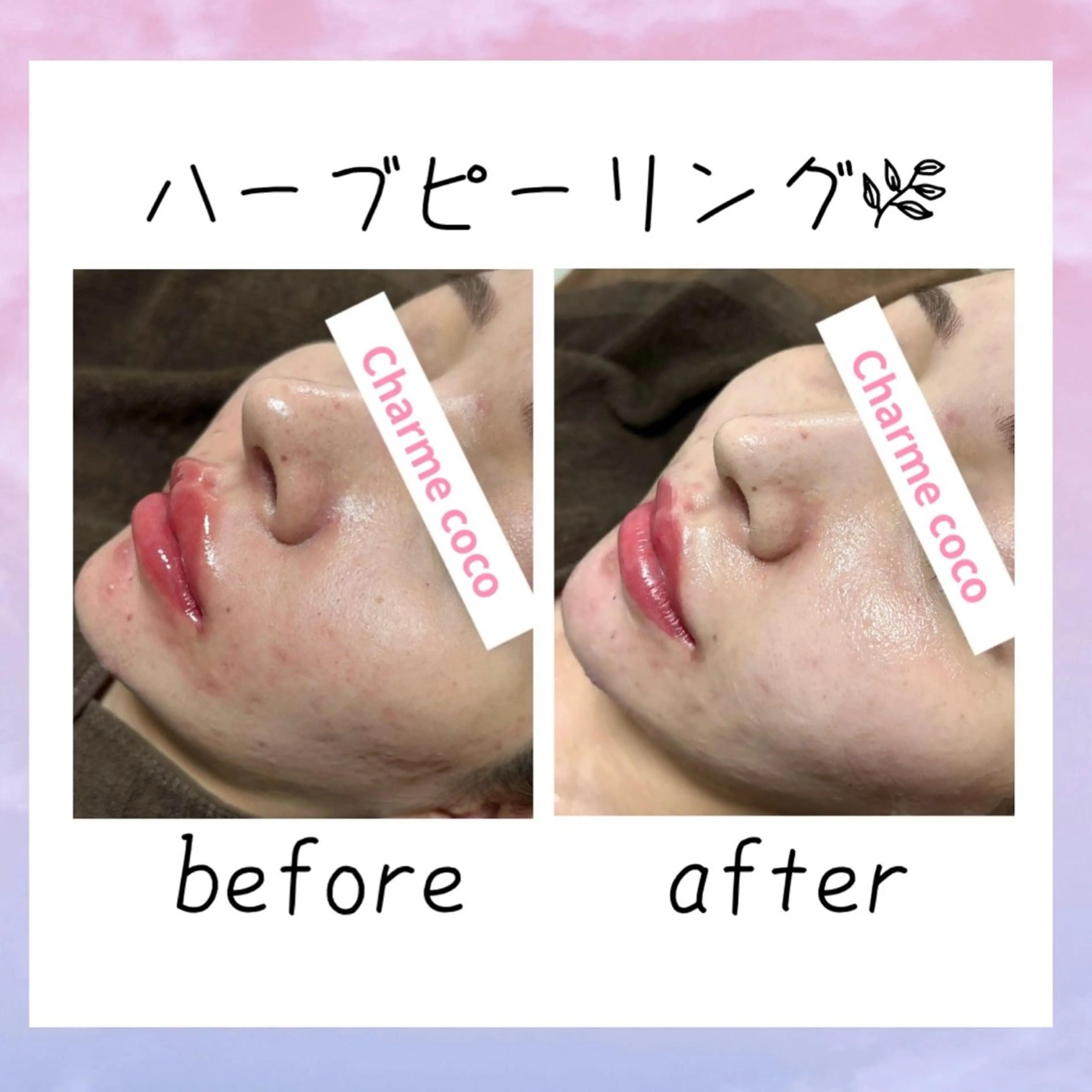 肌質改善Charme coco  増毛のエステ・リラクイメージ