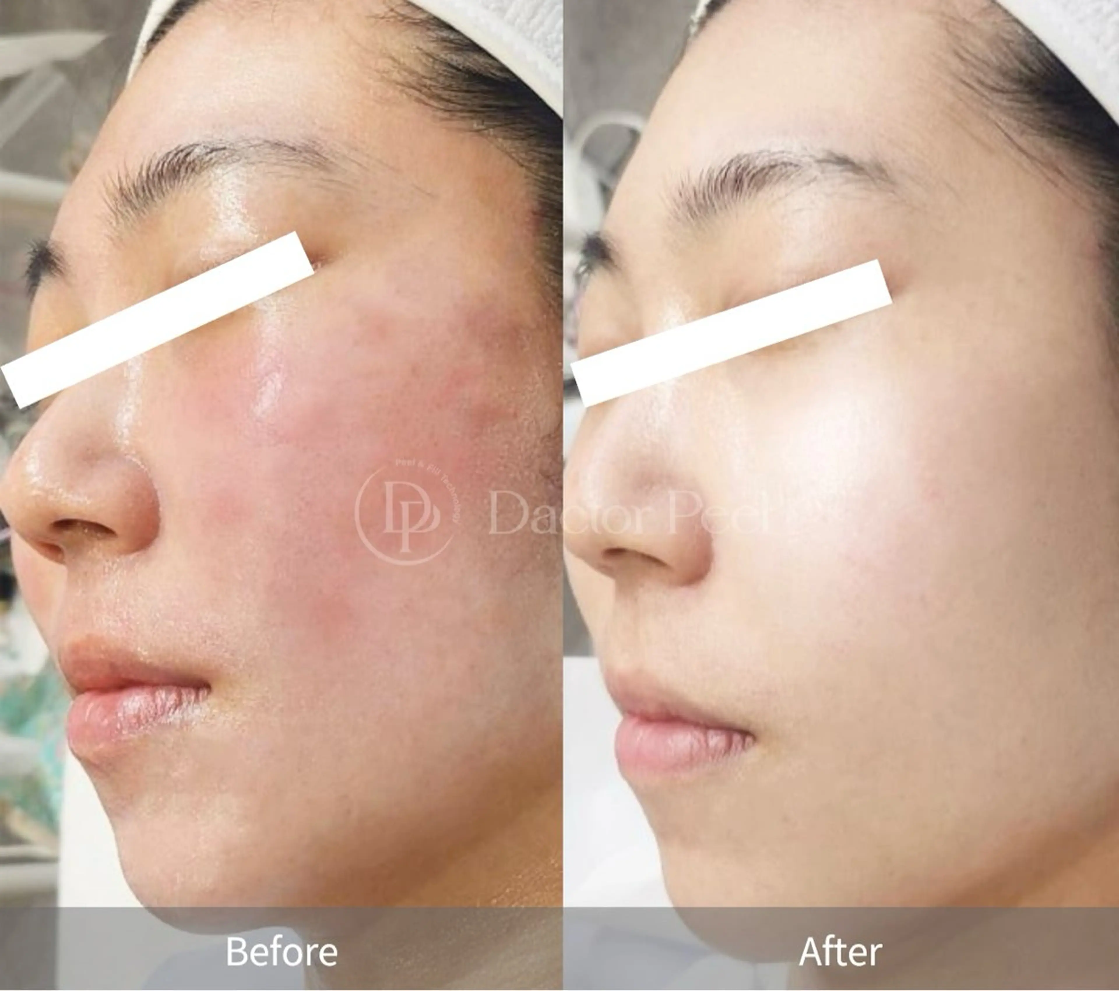 Honey Moom所属・Honey Moomのエステ・リラクイメージ