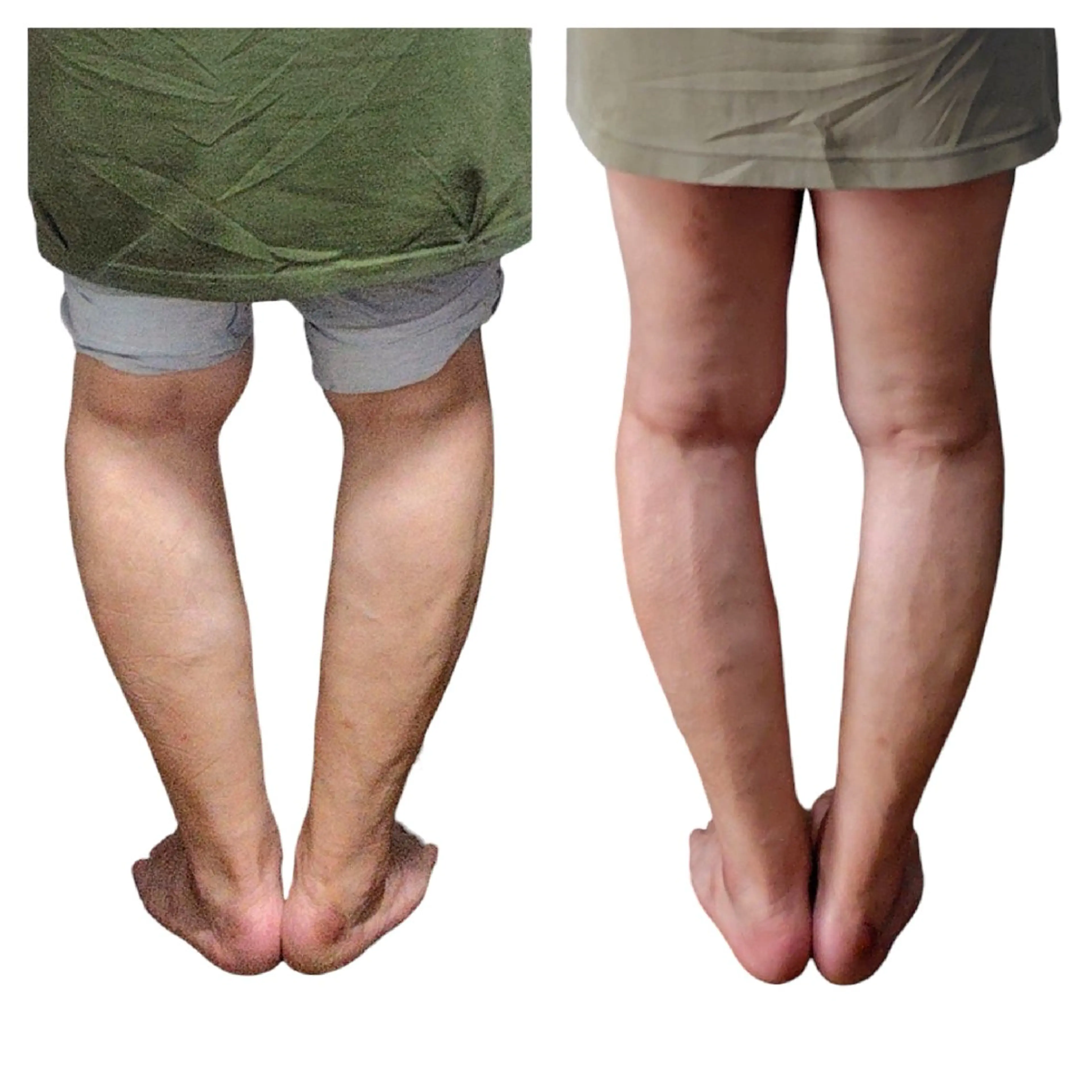 Ichi Fluorite Body所属・Ichi Fluo rite Bodyのエステ・リラクイメージ