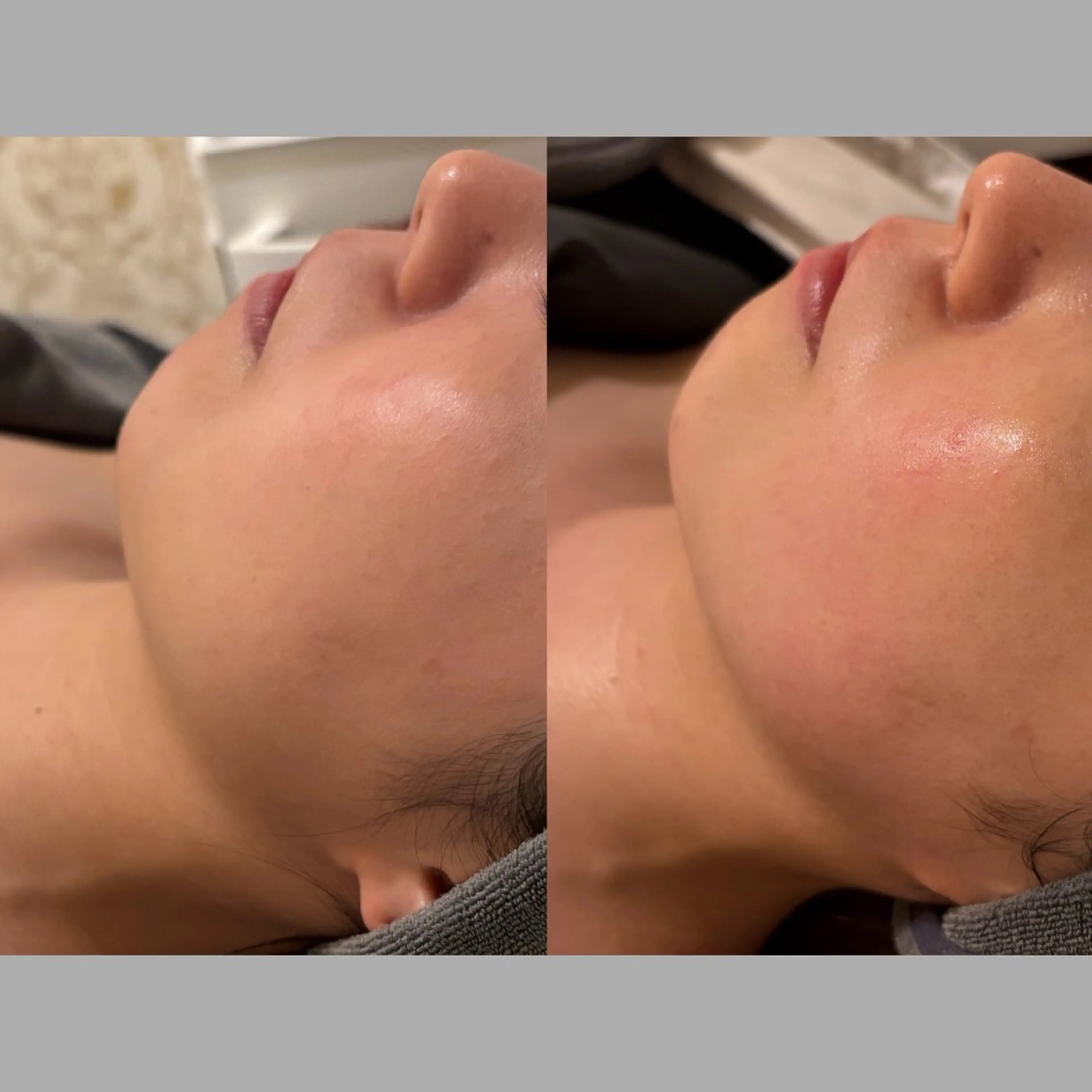 エステ ☆痩身/小顔☆ コルギのエステ・リラクイメージ