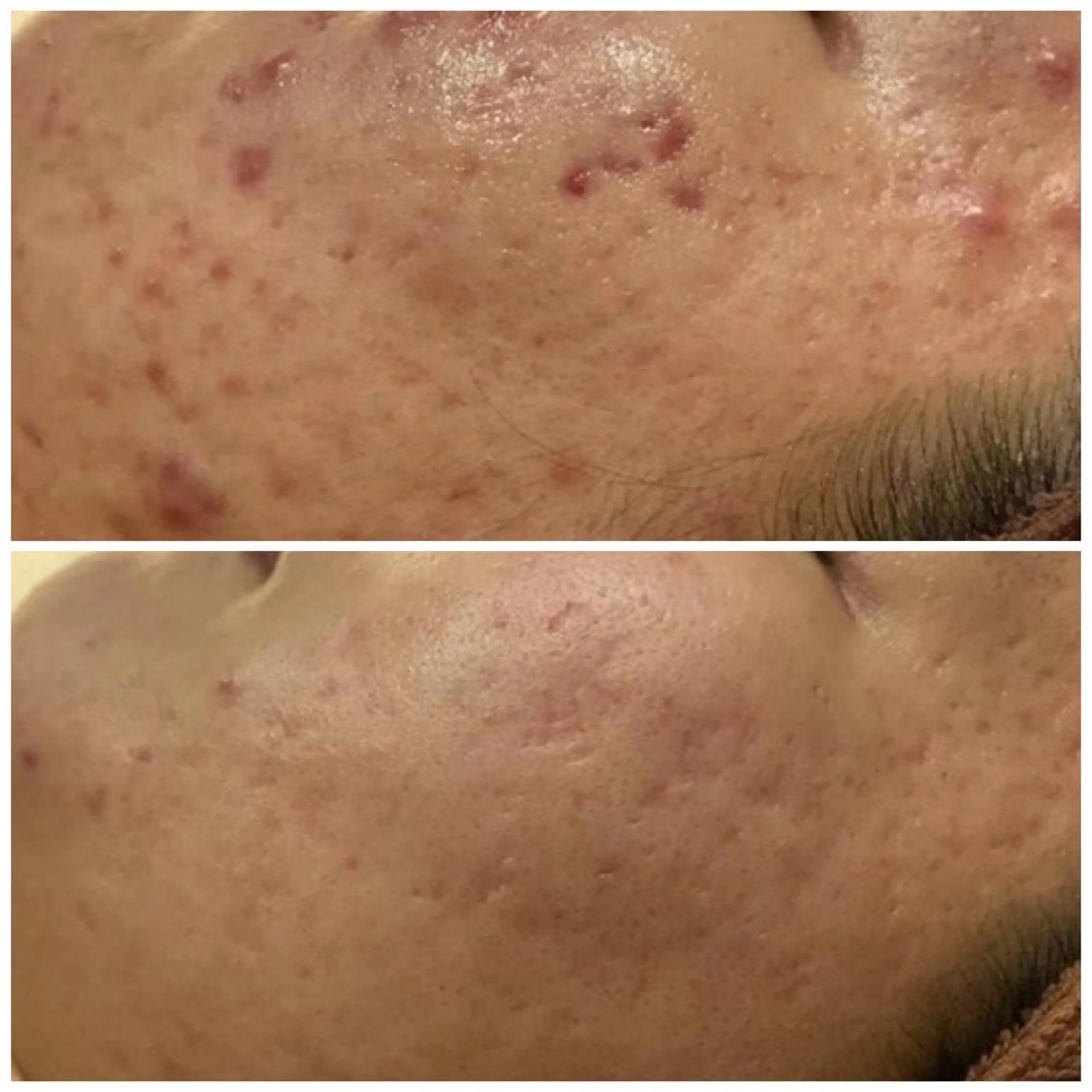 触れたくなる モテ肌へ...❤︎のエステ・リラクイメージ