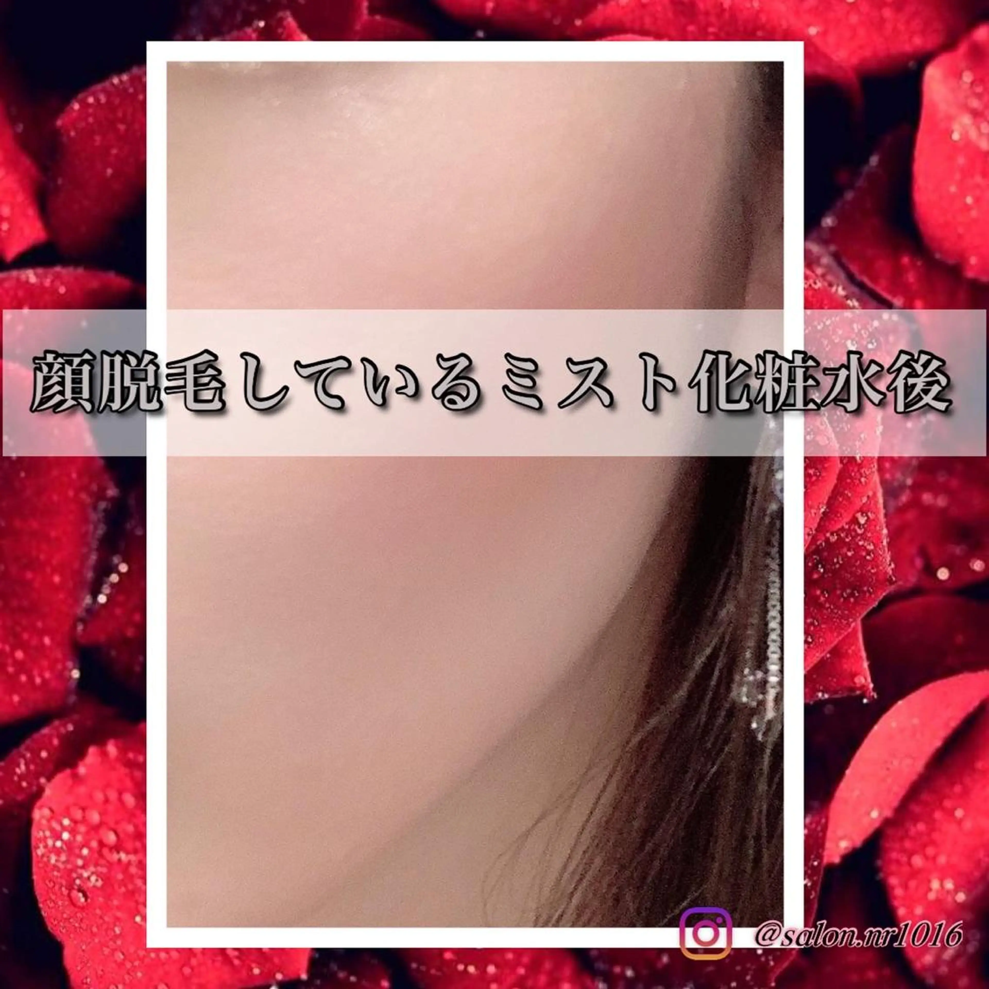 脱毛 脱毛サロン NR エヌアール所属・NR Nara yukiのエステ・リラクイメージ