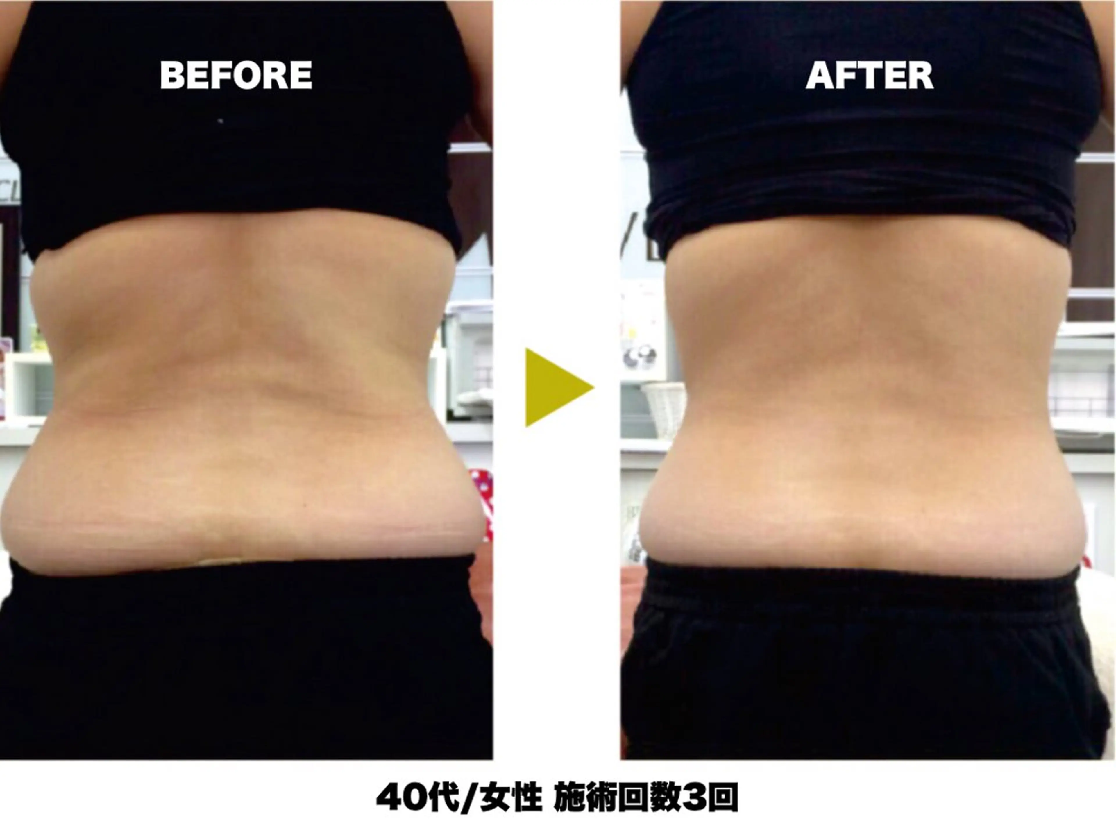 エステ 【痩身/ダイエット】 オーバイワン横浜🍓のエステ・リラクイメージ