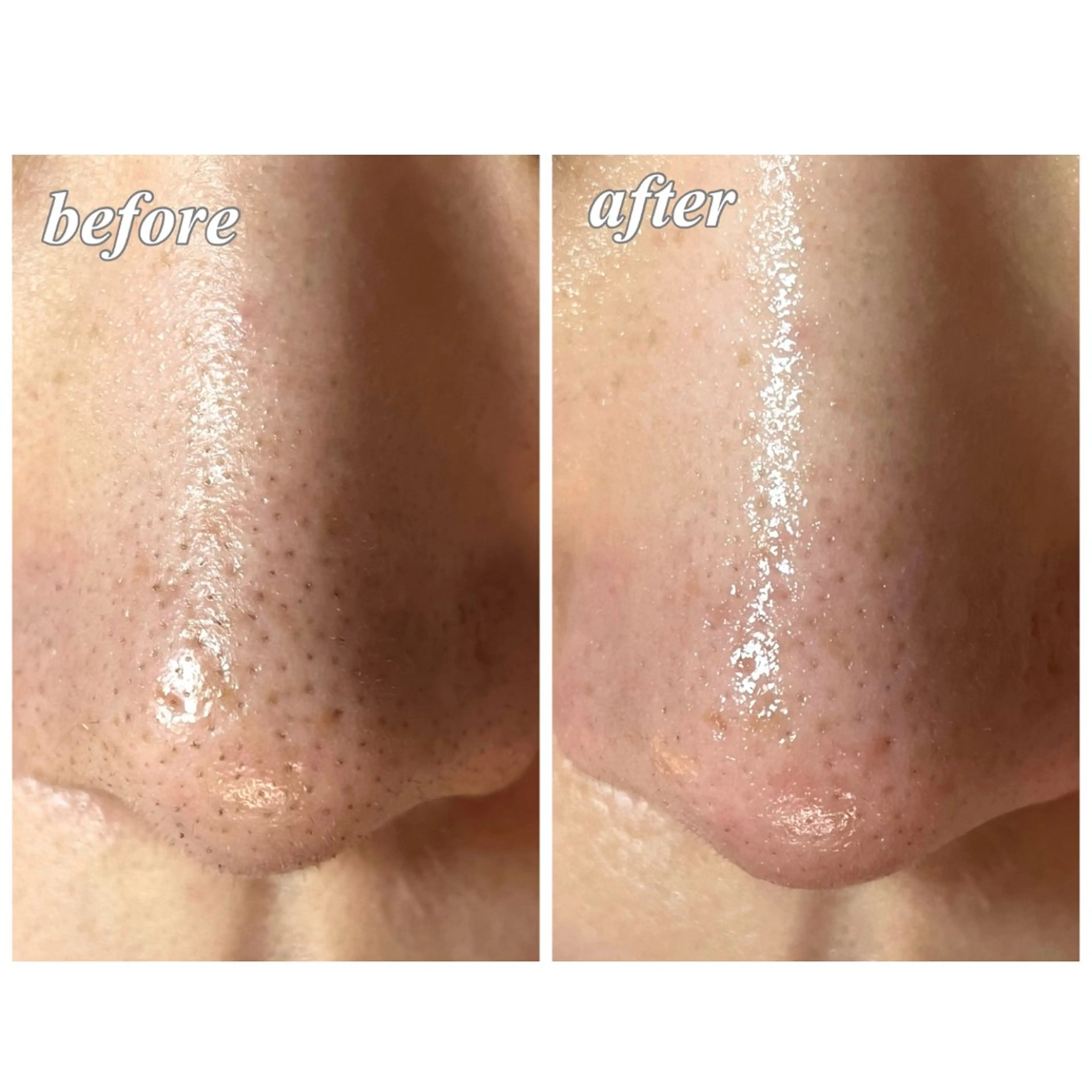 結果重視｜毛穴エステ ｜友綱理恵のエステ・リラクイメージ