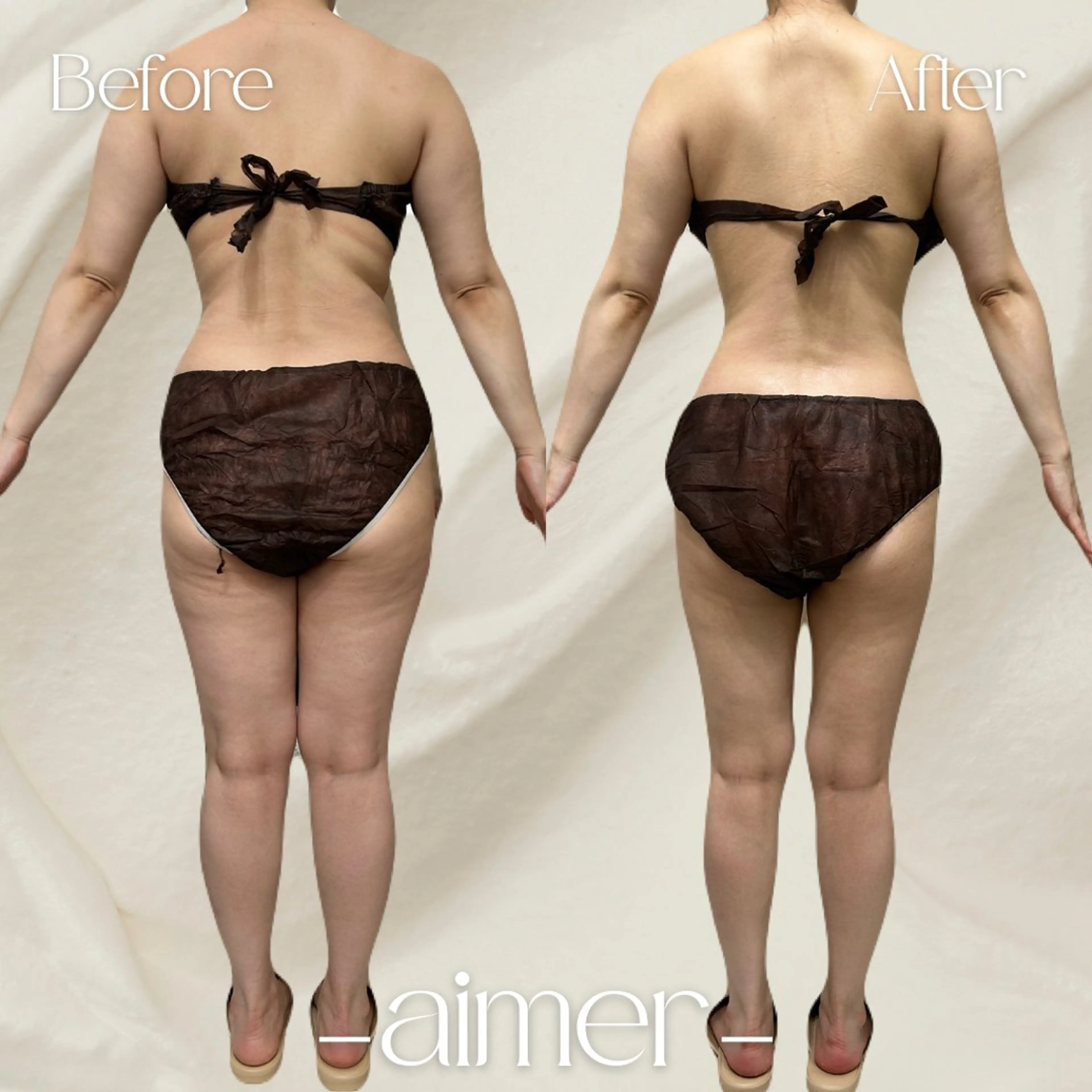 [ミニモ学割]U24限定‪‪❤︎‬全身‪‪❤︎‬ハイパーナイフ90分の写真