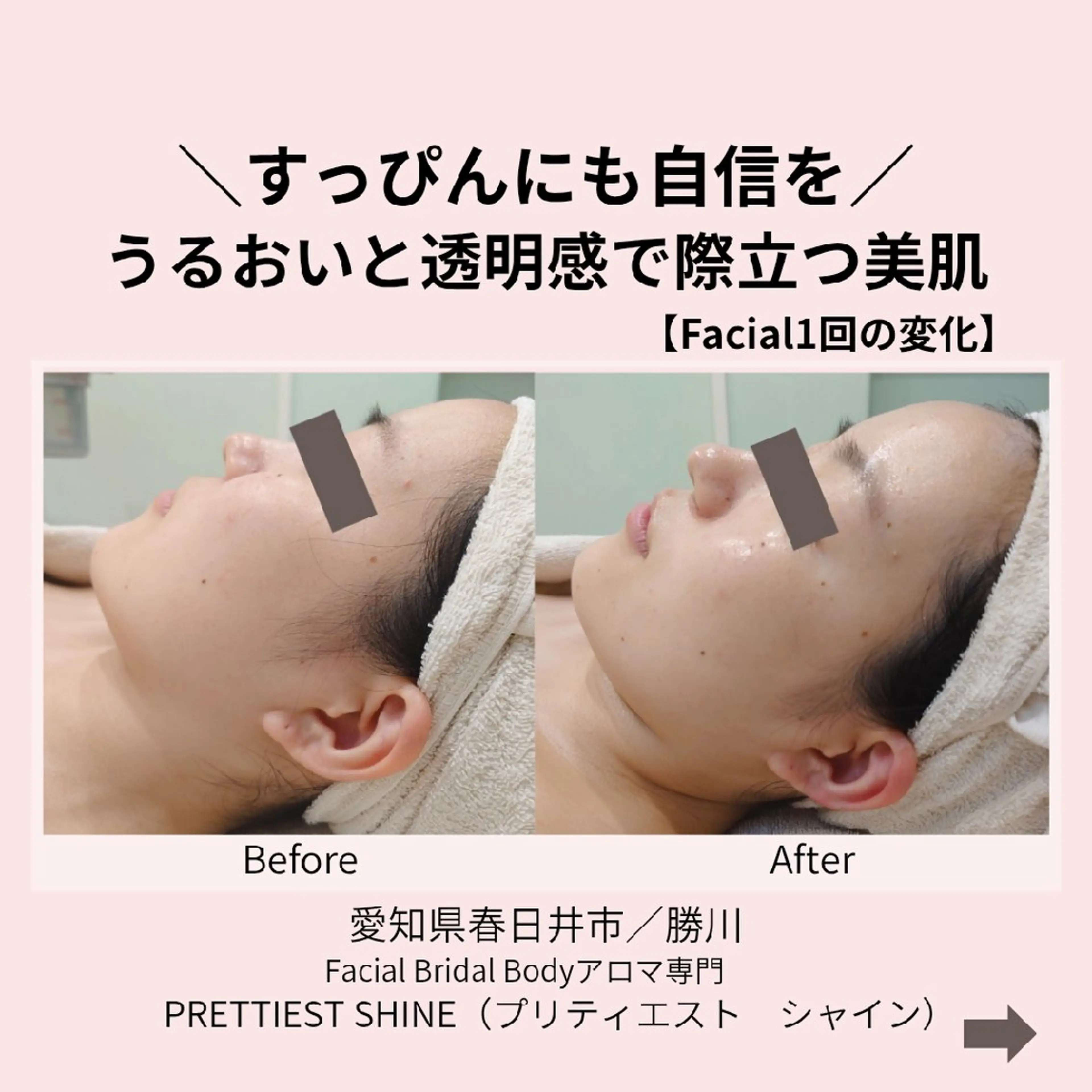 エステ PRETTIEST SHINE所属・山田 浩子のエステ・リラクイメージ